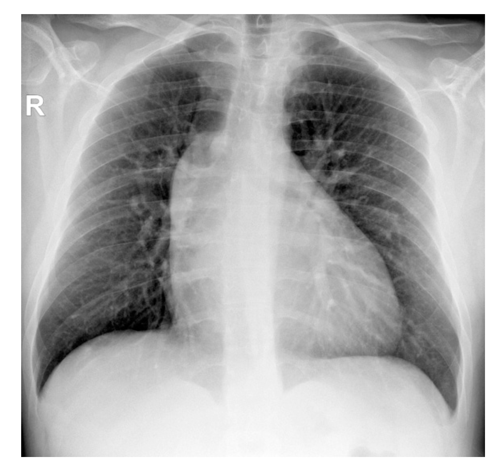 Diagnostics 11 00446 g002 Diagnostics 11 00446 g002