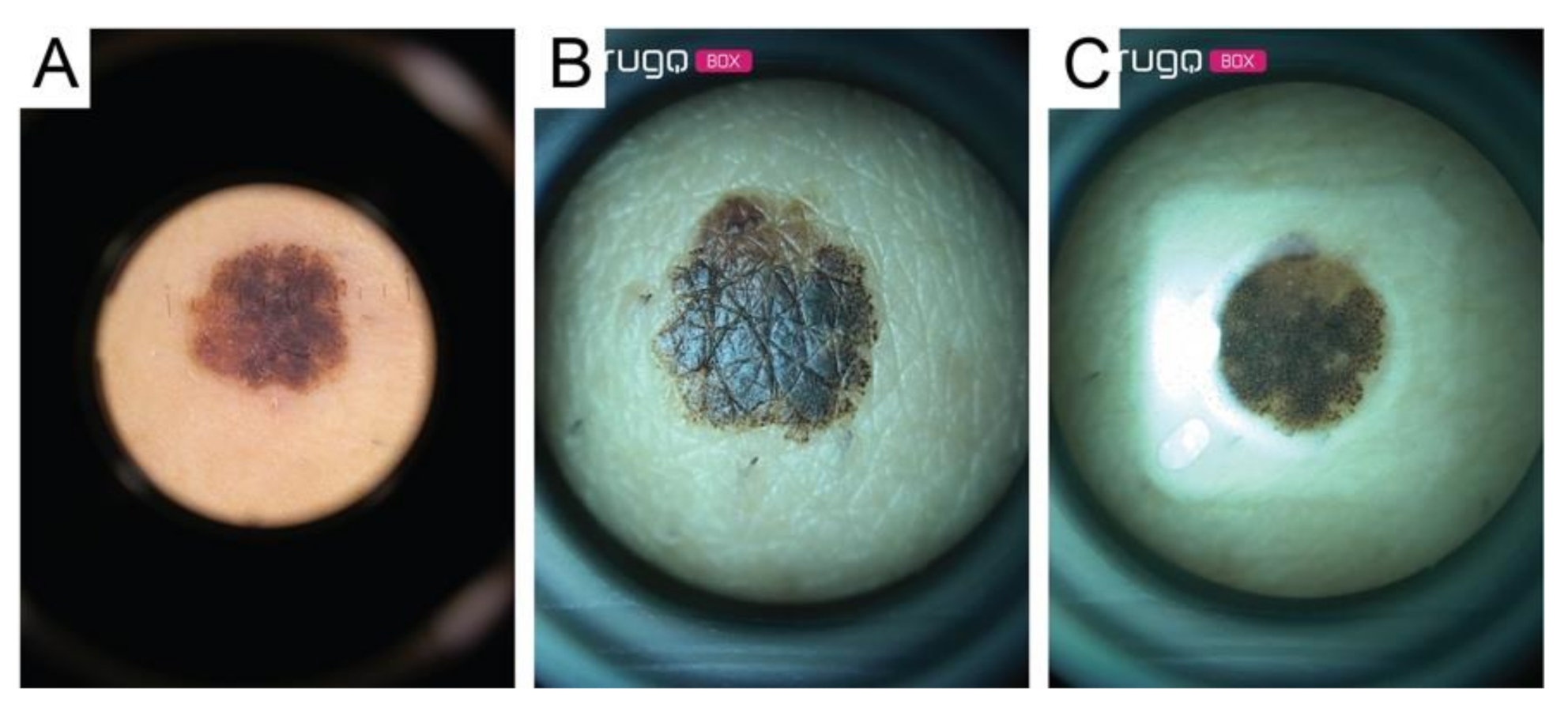 Diagnostics 11 00451 g004