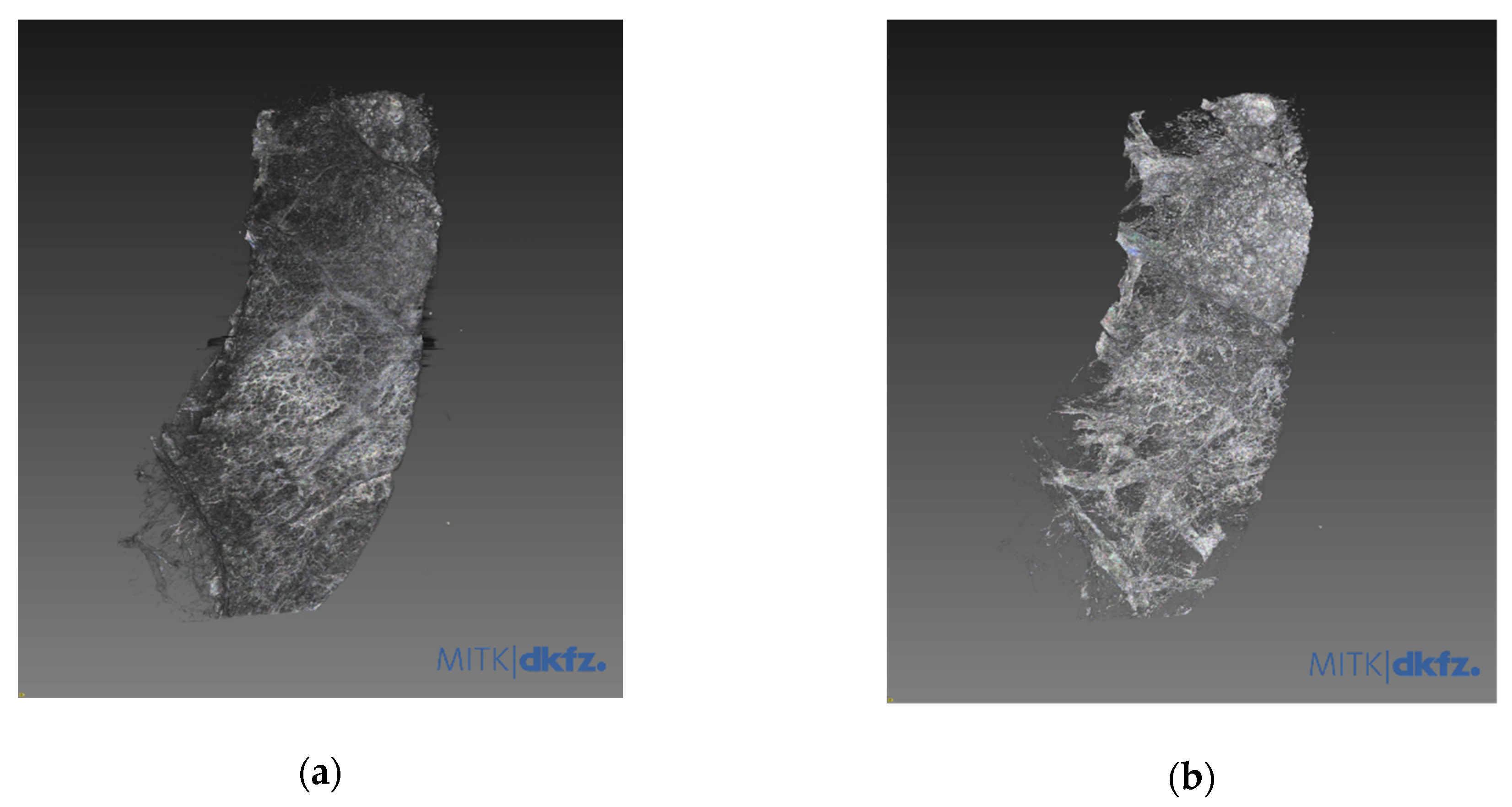 Diagnostics 11 00487 g004