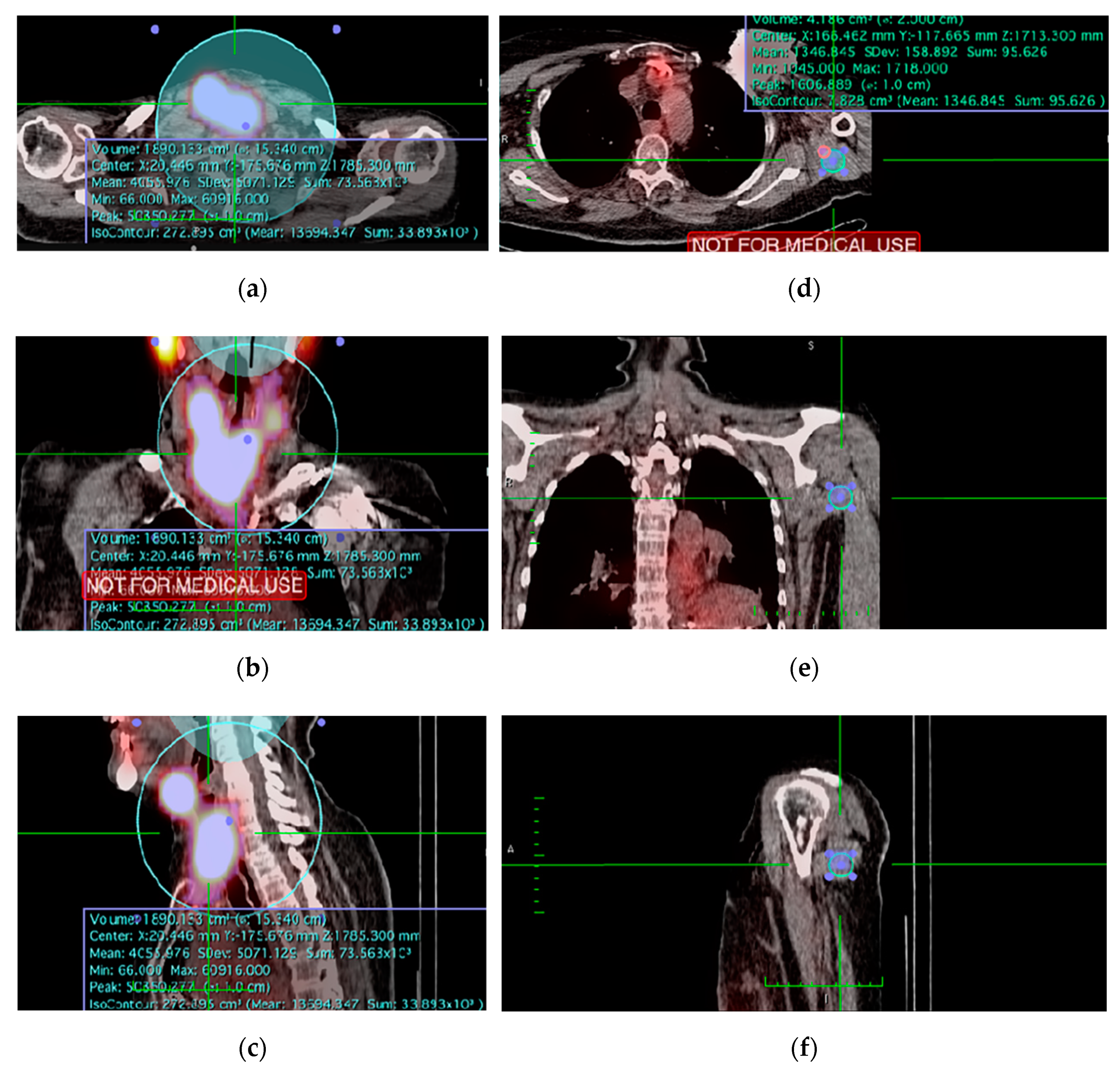 Diagnostics 11 00553 g002 Diagnostics 11 00553 g002