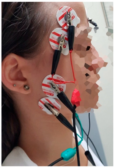 trapezius-trigger-point-interactions