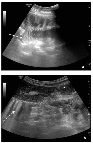 what causes ileus in dogs