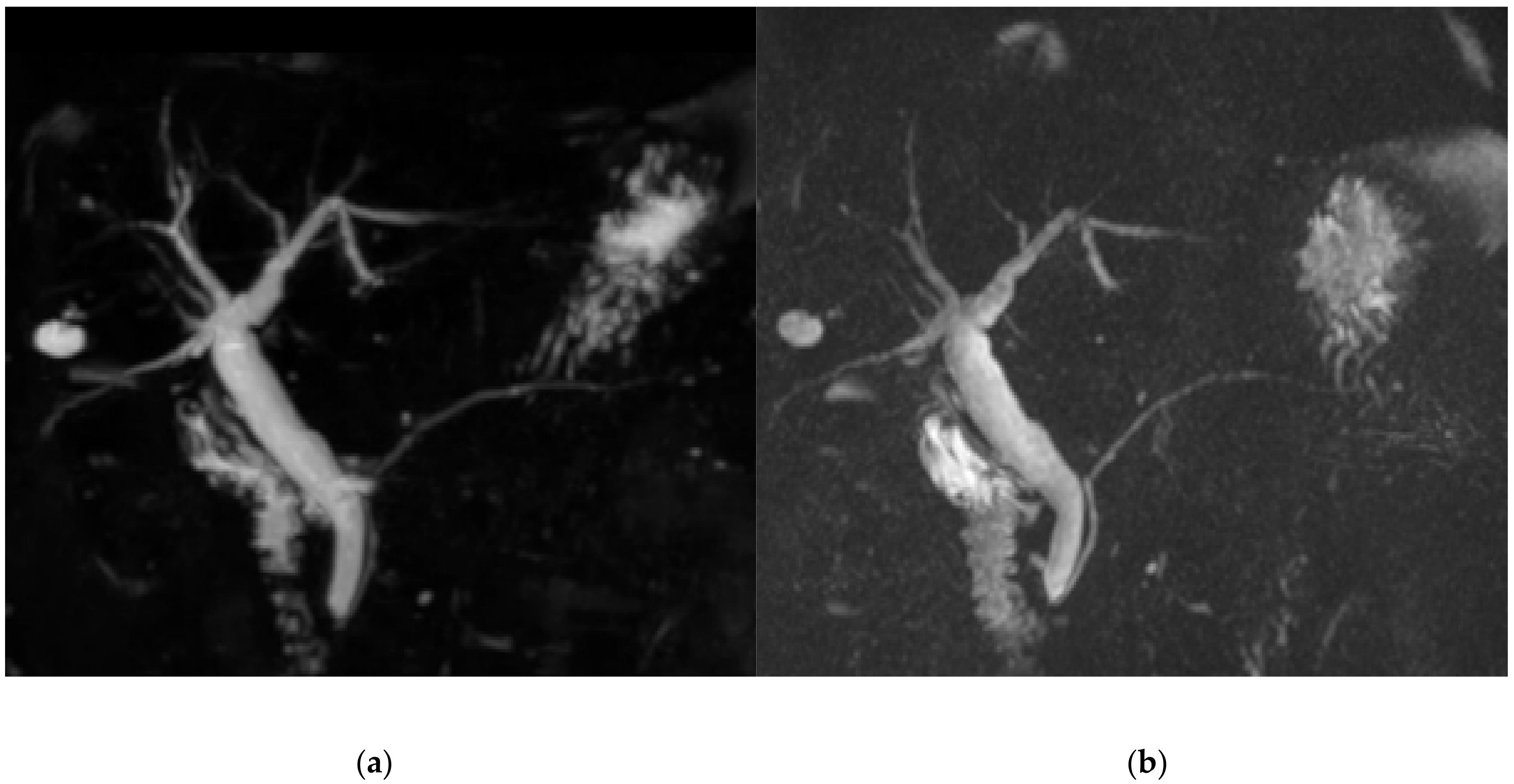 Diagnostics 11 00634 g003