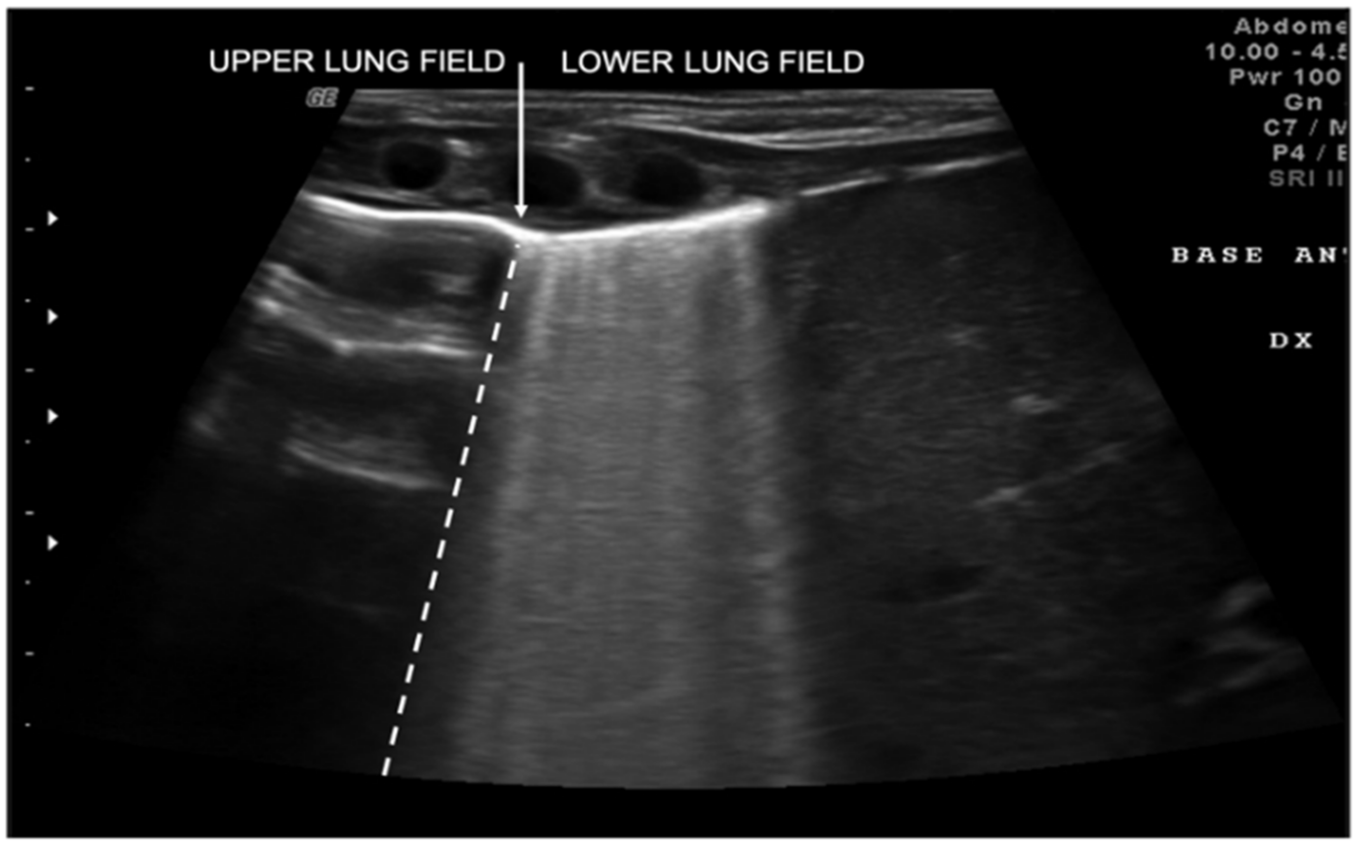 Diagnostics 11 00652 g005