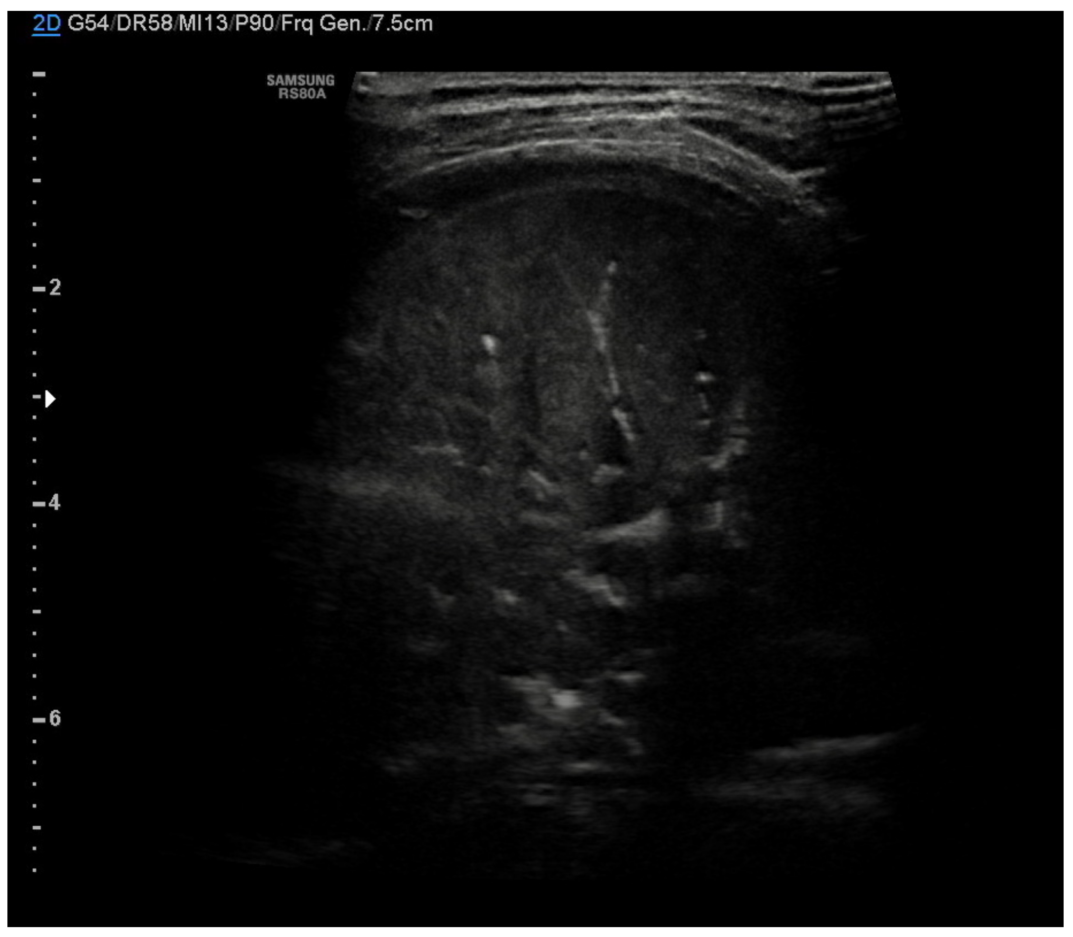 Diagnostics 11 00652 g007