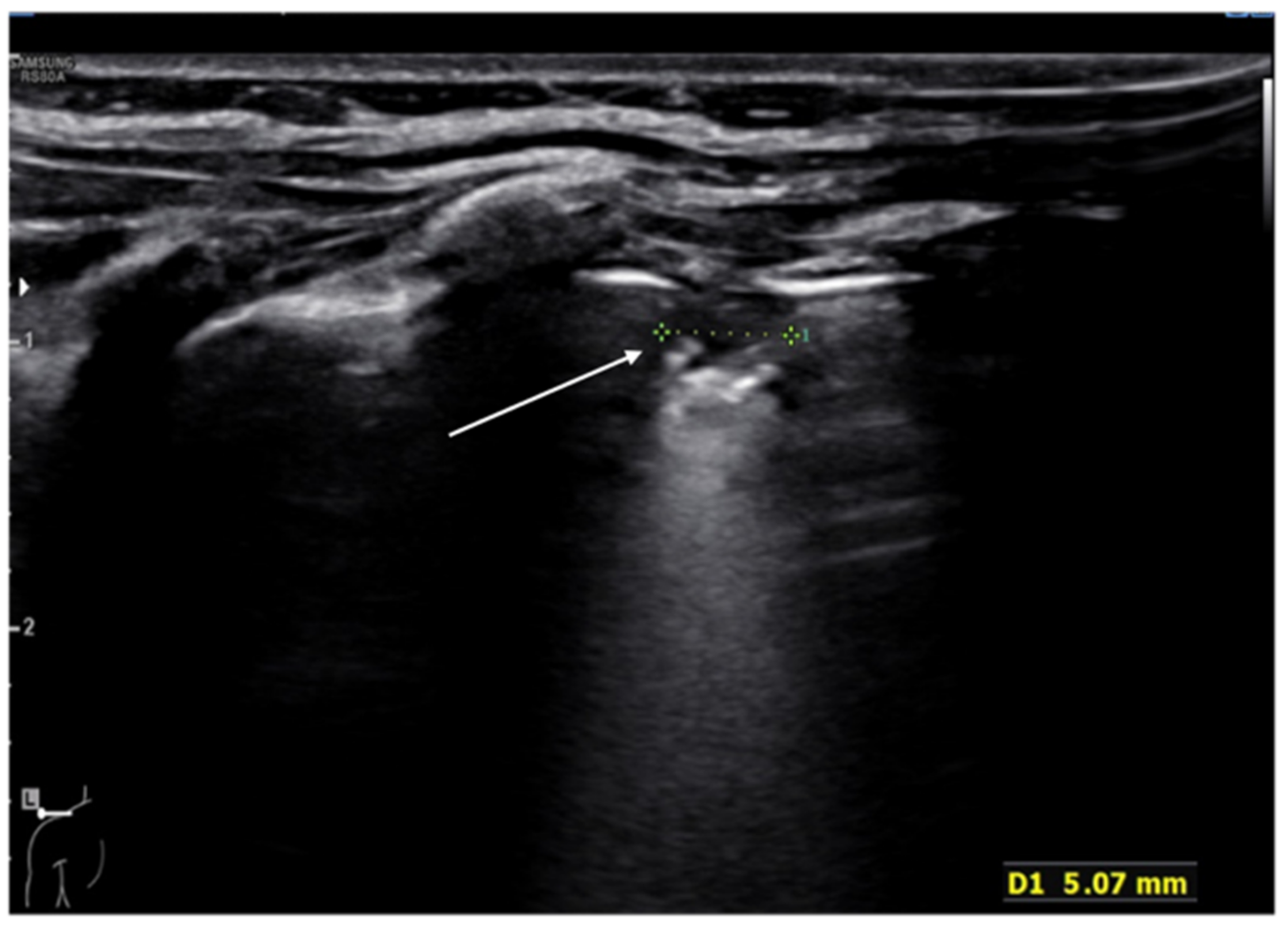 Diagnostics 11 00652 g009