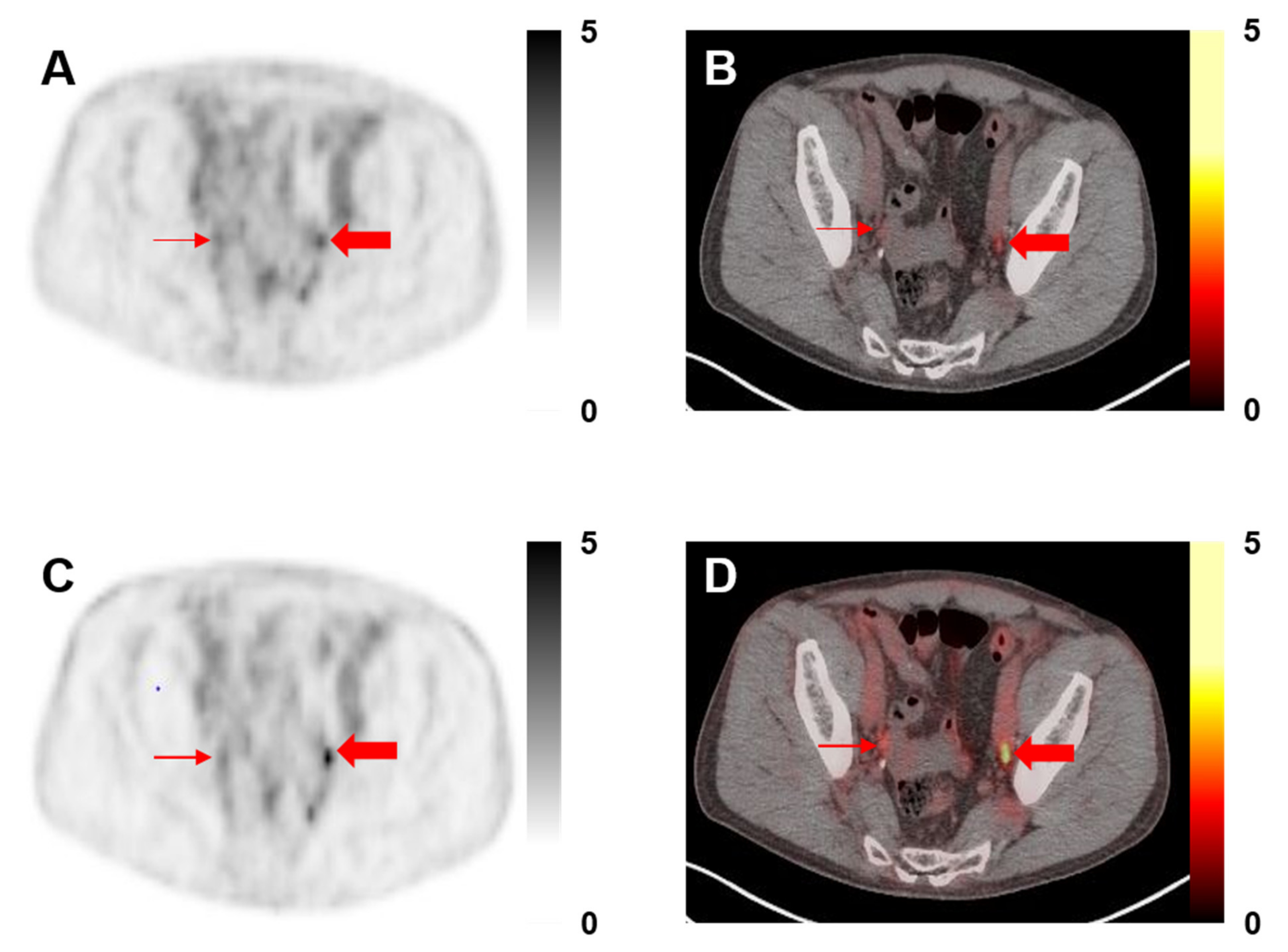 PDF) Point-spread function reconstructed PET images of sub