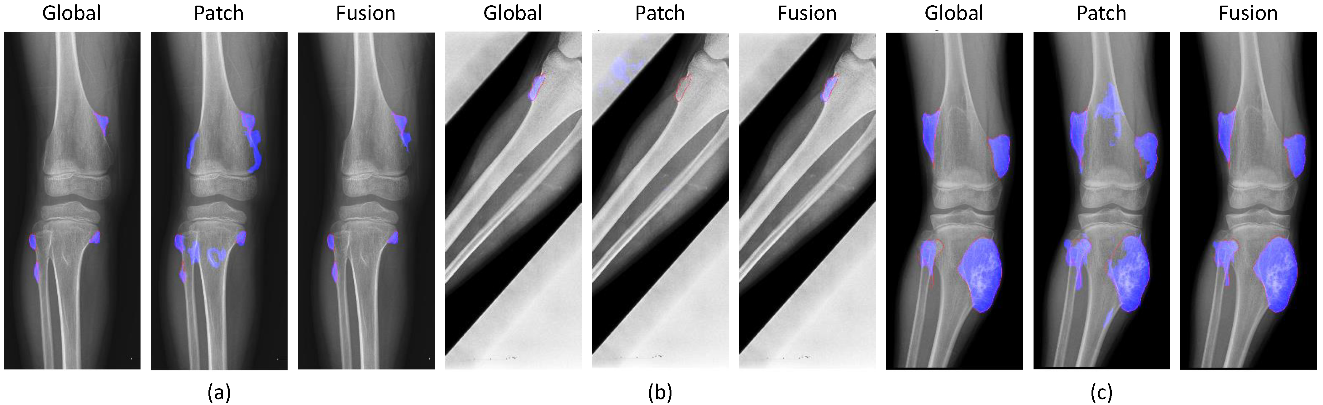 Diagnostics 11 00691 g011 Diagnostics 11 00691 g011