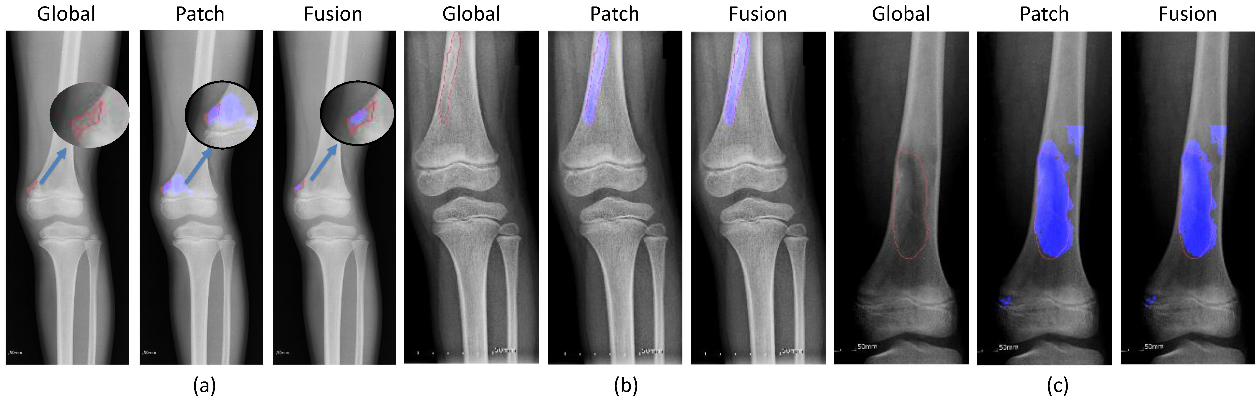 Diagnostics 11 00691 g012 Diagnostics 11 00691 g012