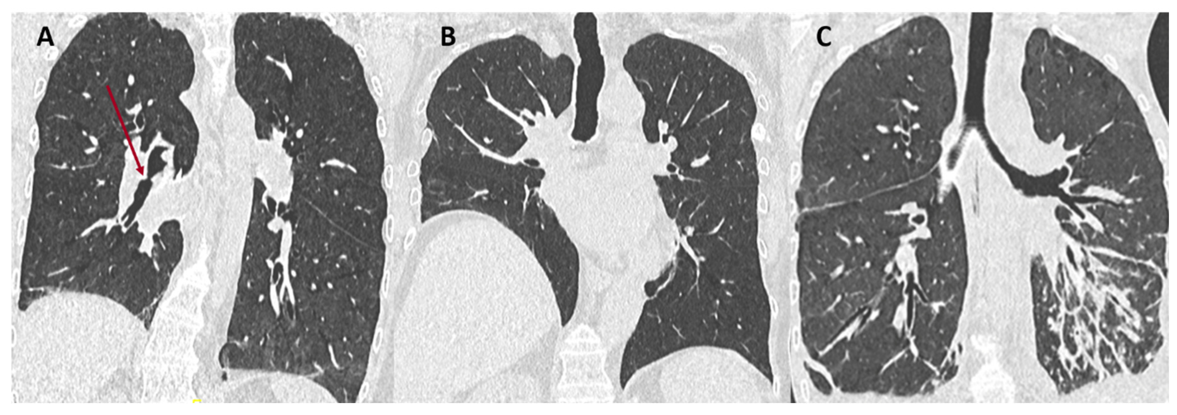 Diagnostics 11 00817 g001 Diagnostics 11 00817 g001