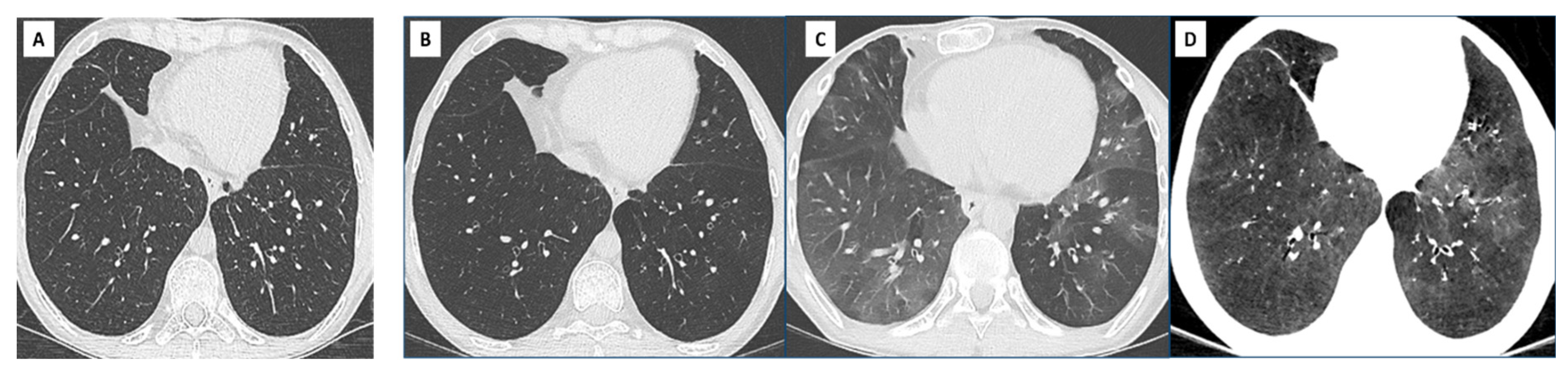 Diagnostics 11 00817 g003 Diagnostics 11 00817 g003