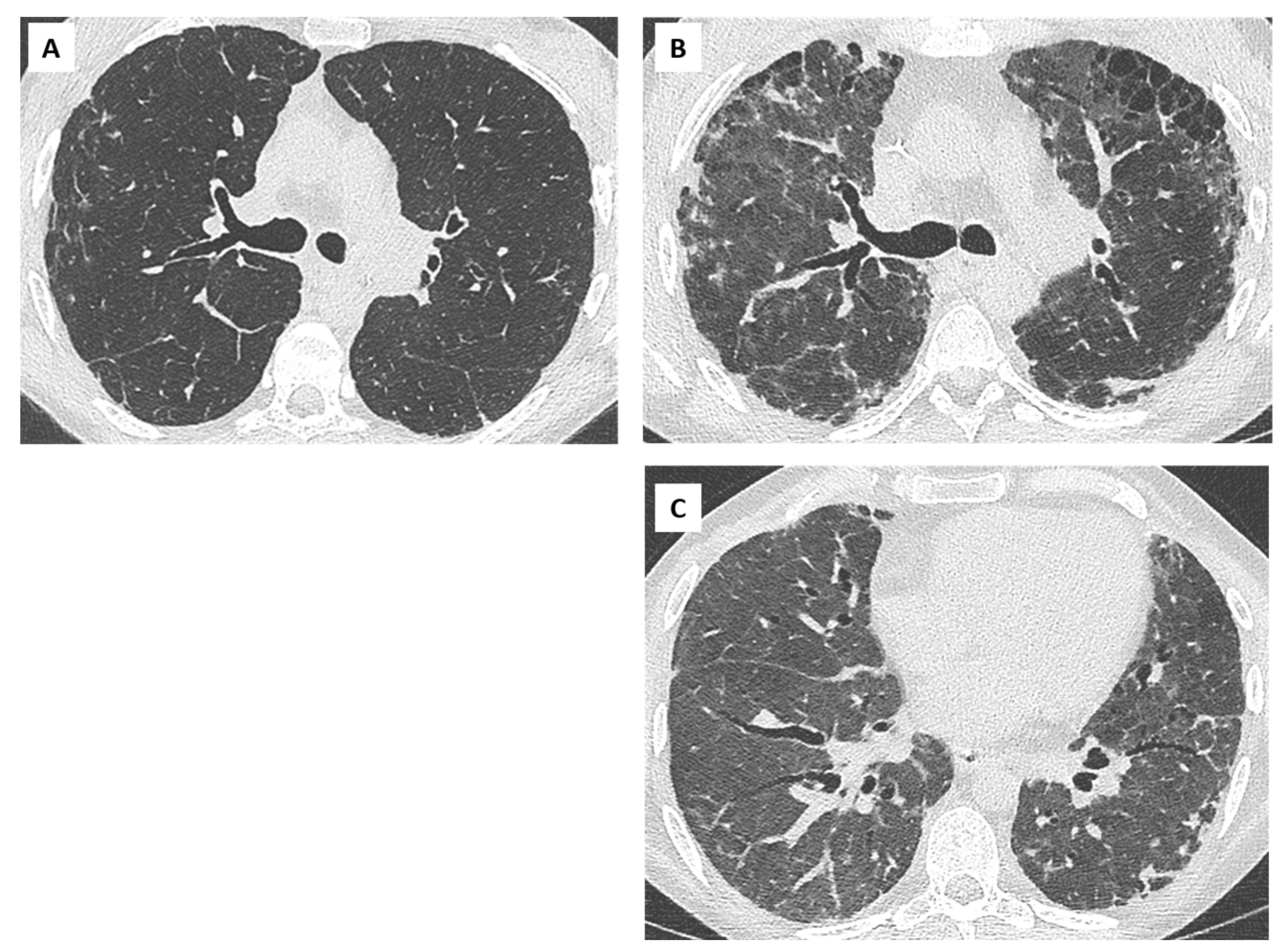 Diagnostics 11 00817 g004 Diagnostics 11 00817 g004
