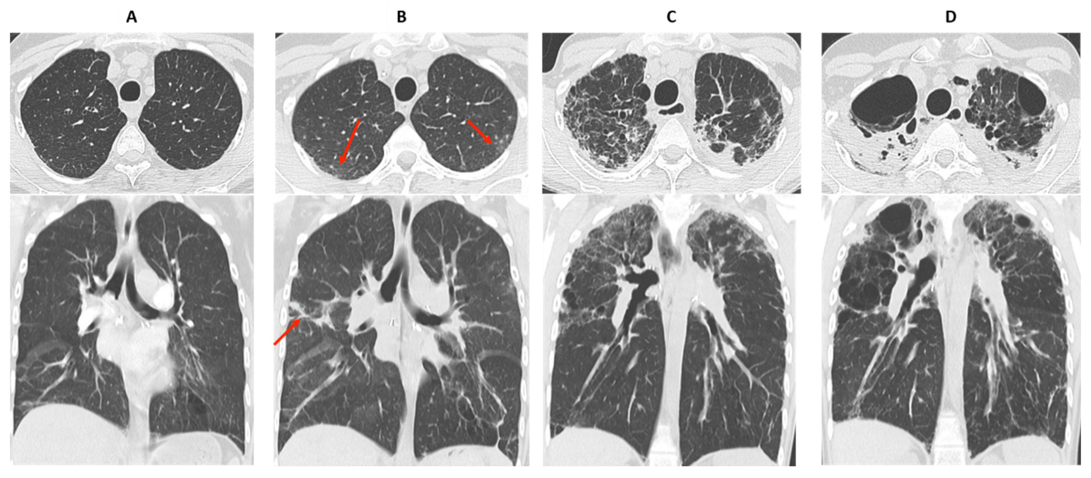 Diagnostics 11 00817 g005 Diagnostics 11 00817 g005