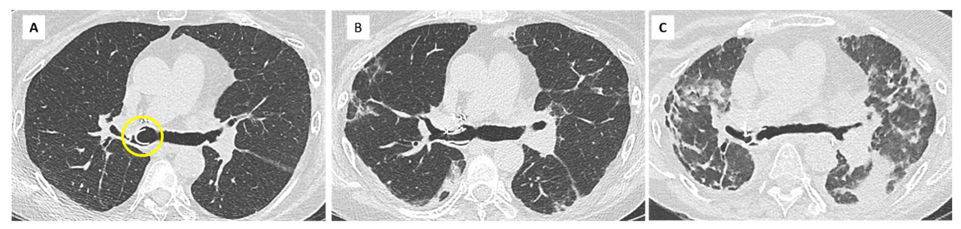 Diagnostics 11 00817 g007 Diagnostics 11 00817 g007