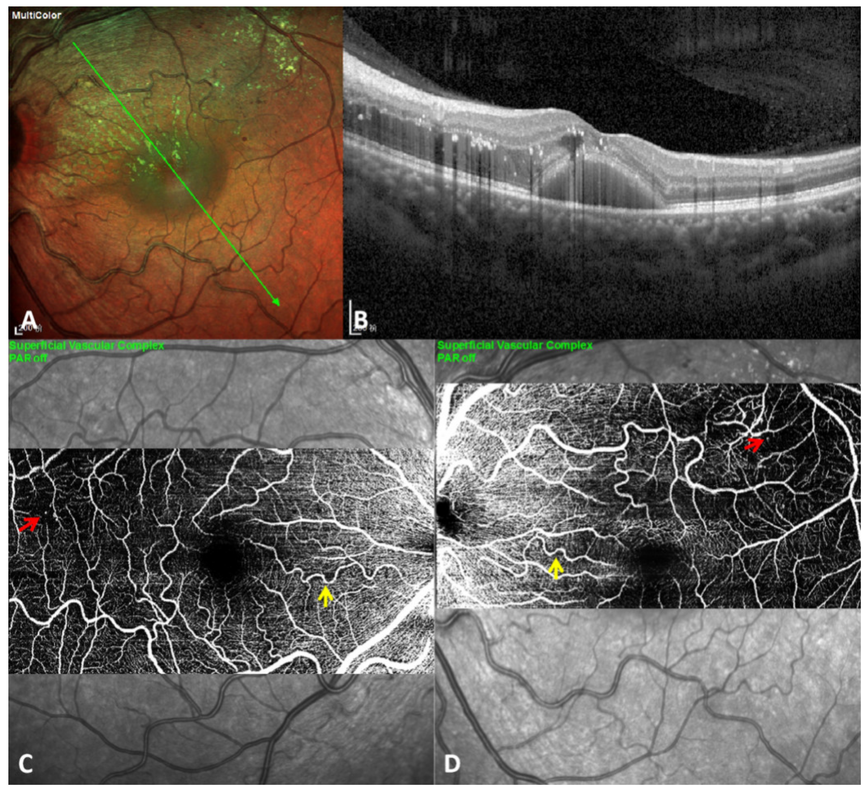 Diagnostics 11 00909 g002