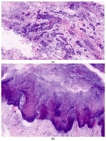 Diagnostics Free Full Text Feasibility And Implementation Of Ex