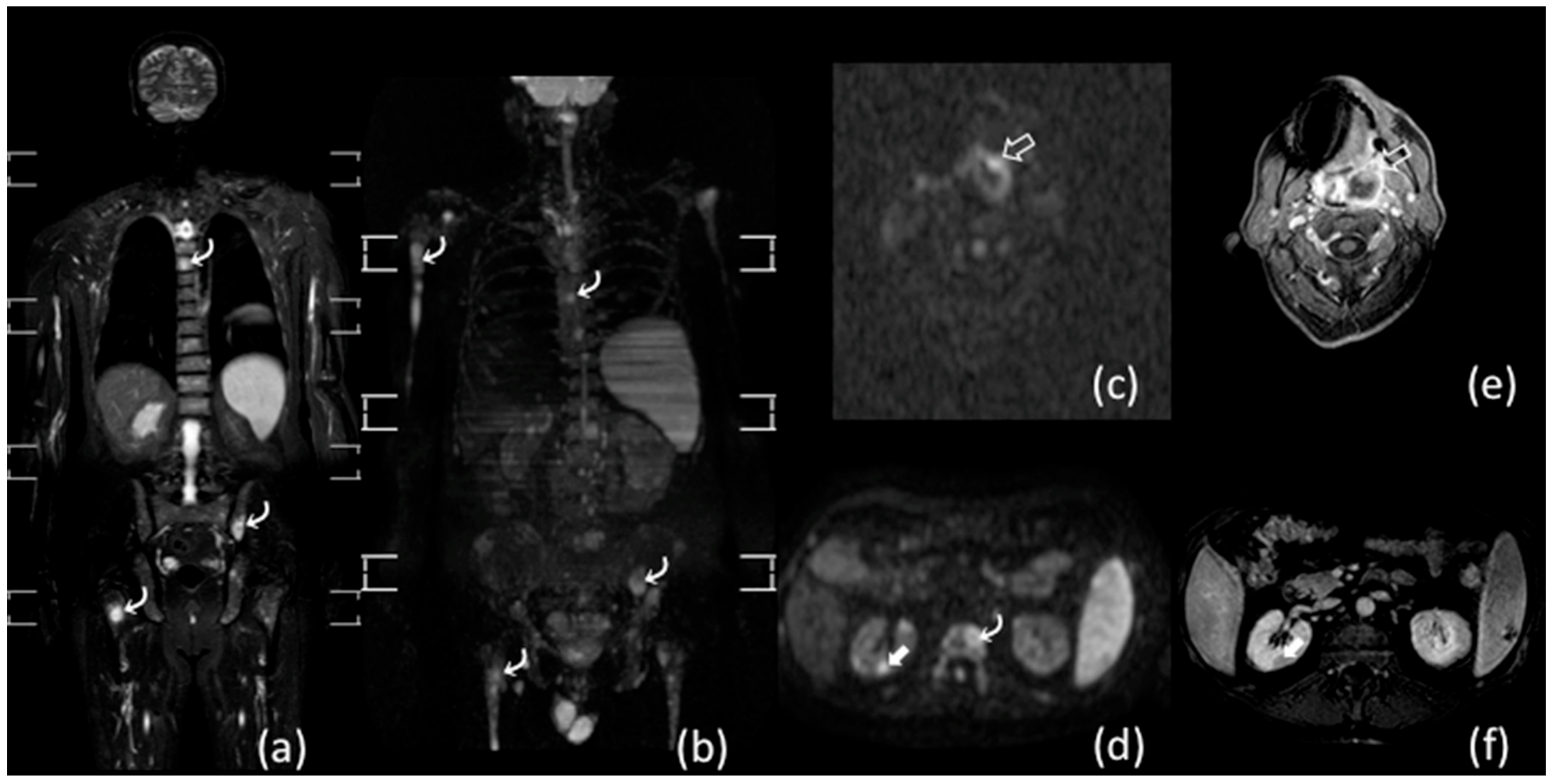 Diagnostics 11 01007 g002 Diagnostics 11 01007 g002
