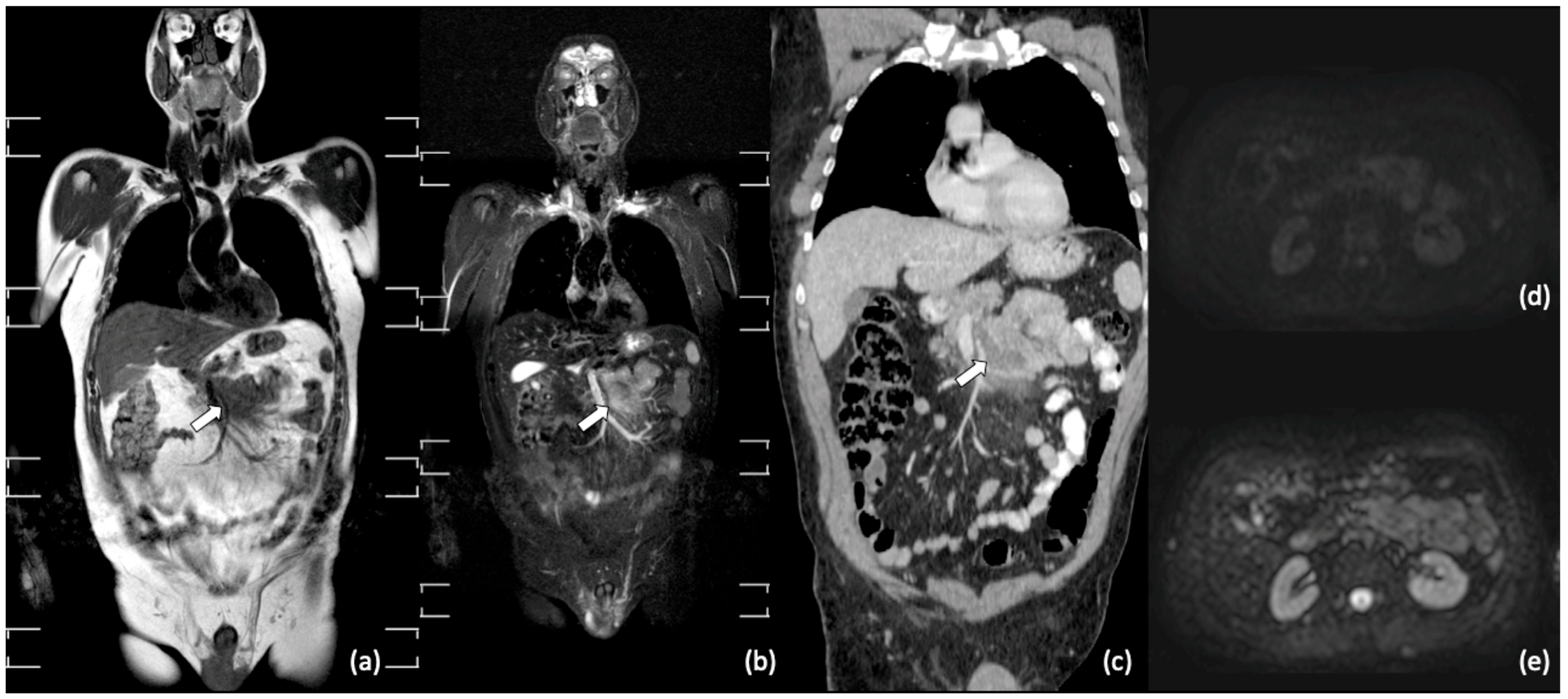 Diagnostics 11 01007 g003 Diagnostics 11 01007 g003
