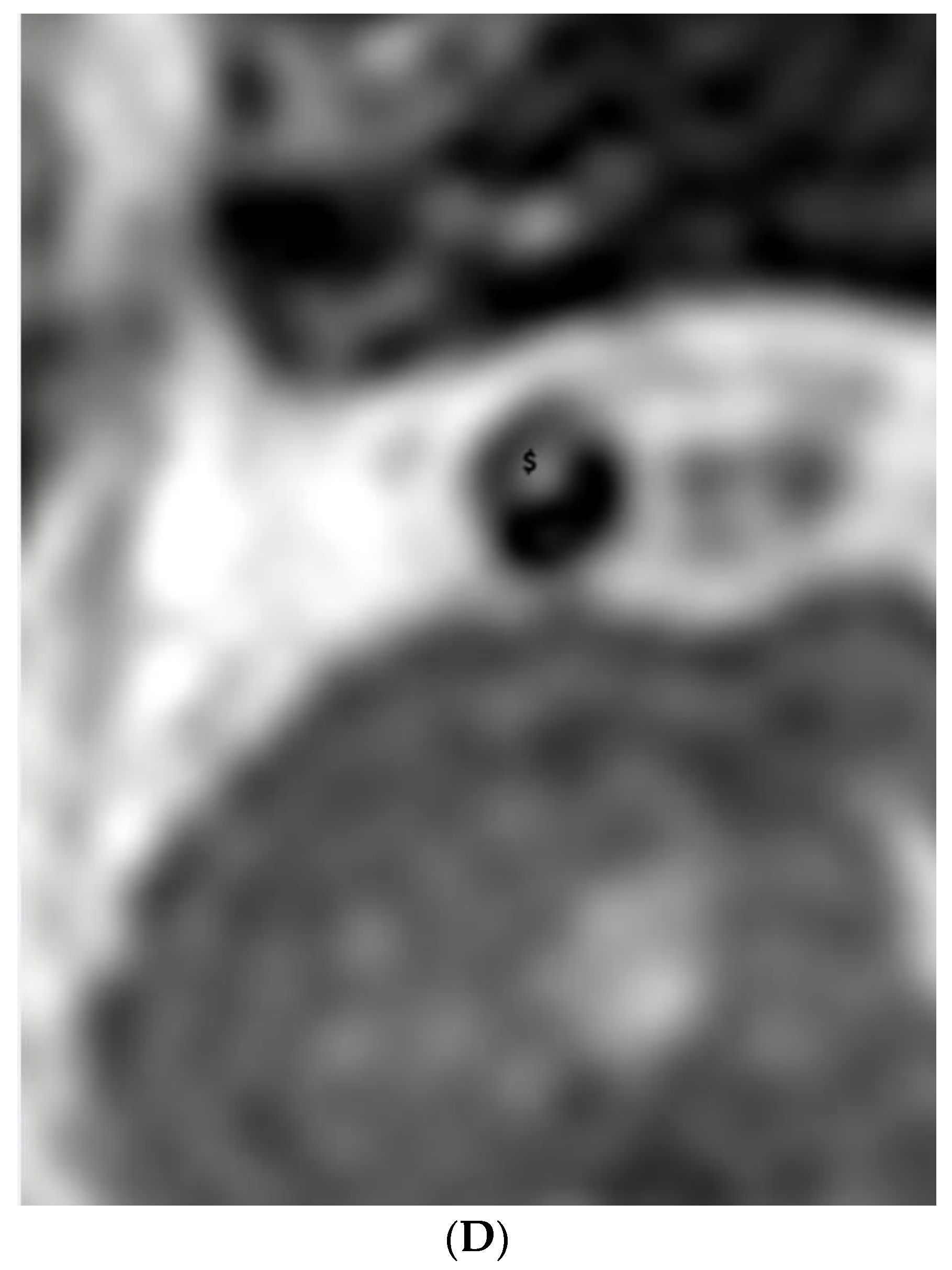 Diagnostics 11 01024 g002c Diagnostics 11 01024 g002c