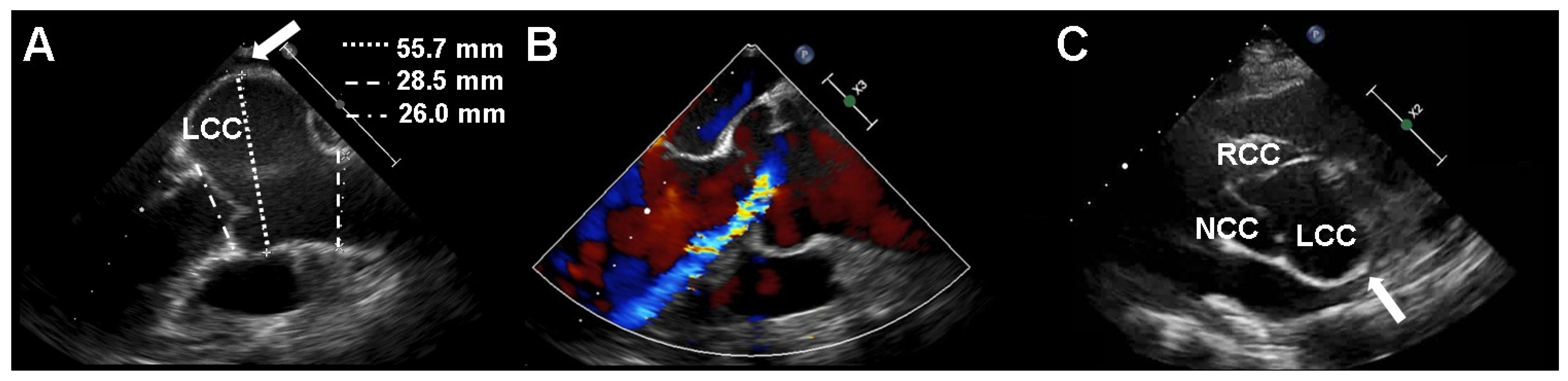 Diagnostics 11 01057 g001