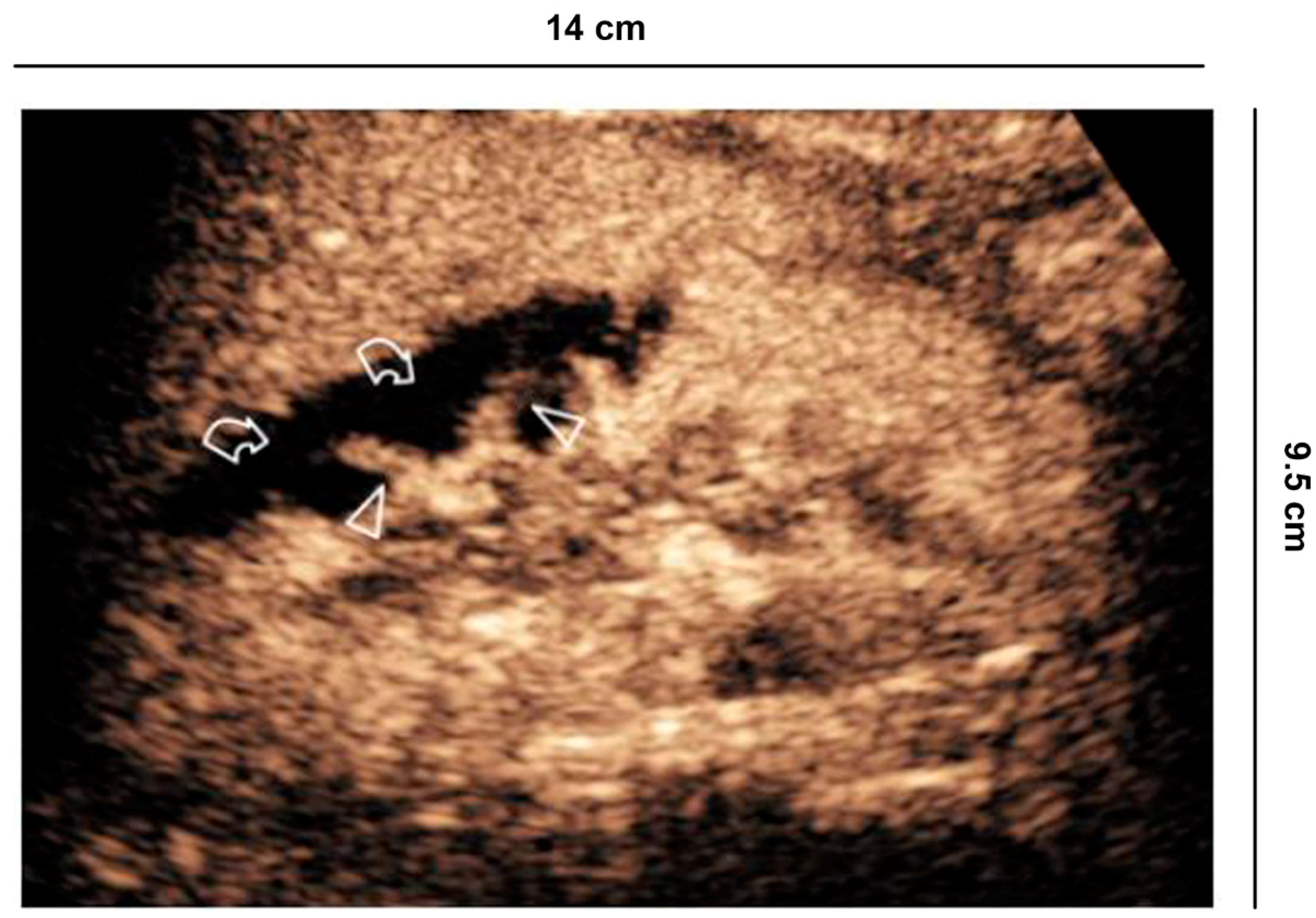 Diagnostics 11 01058 g008 Diagnostics 11 01058 g008