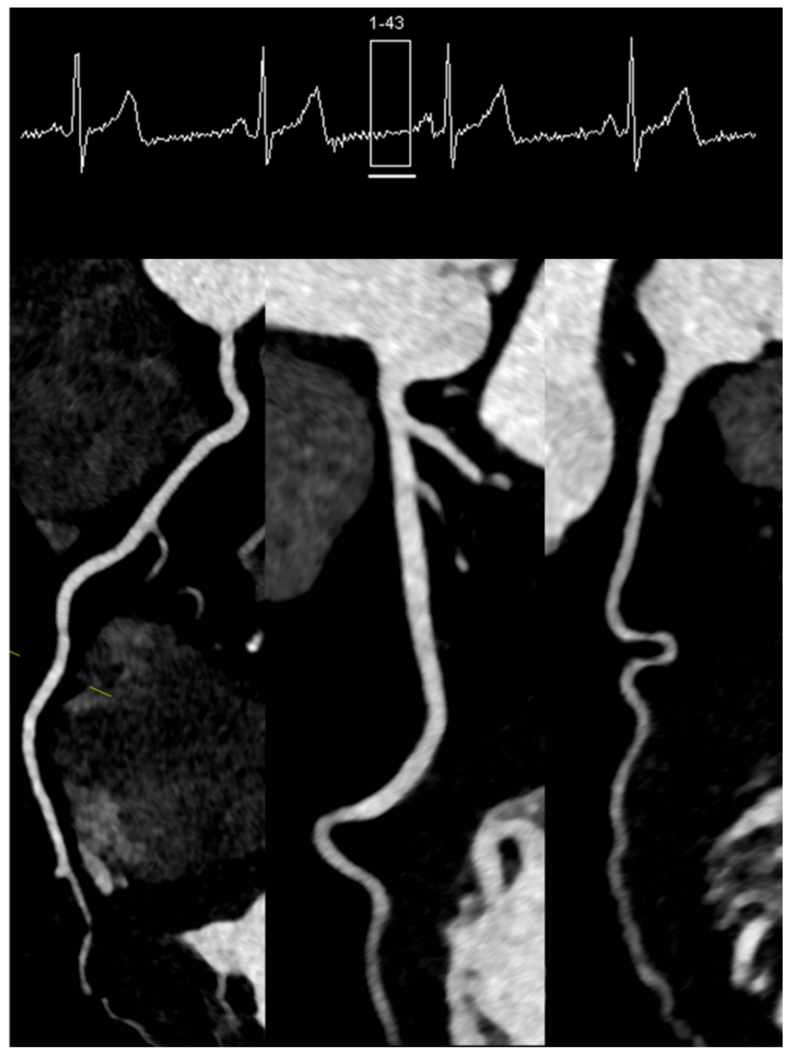 Diagnostics 11 01072 g003 Diagnostics 11 01072 g003