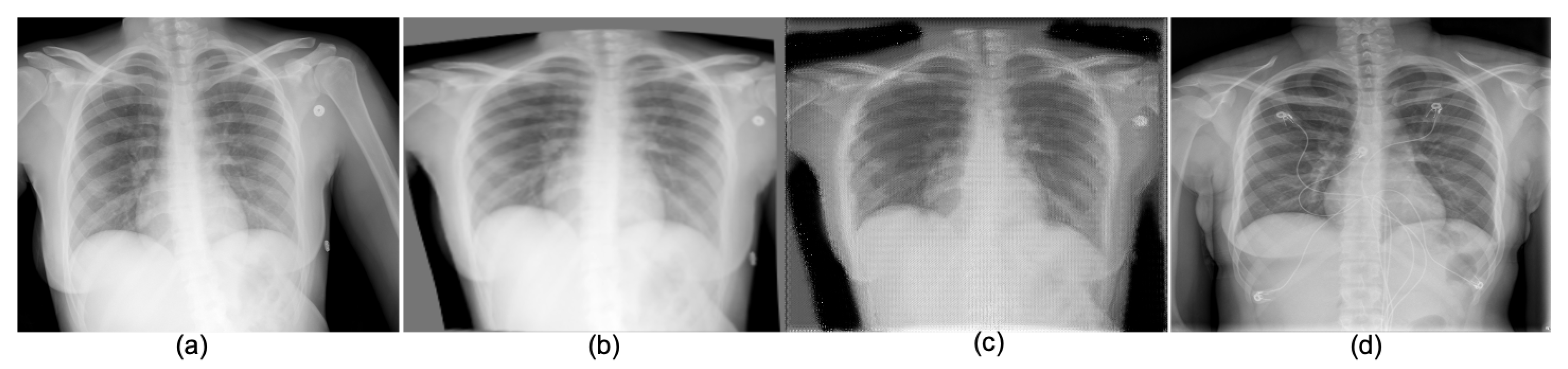 Diagnostics 11 01080 g002 Diagnostics 11 01080 g002
