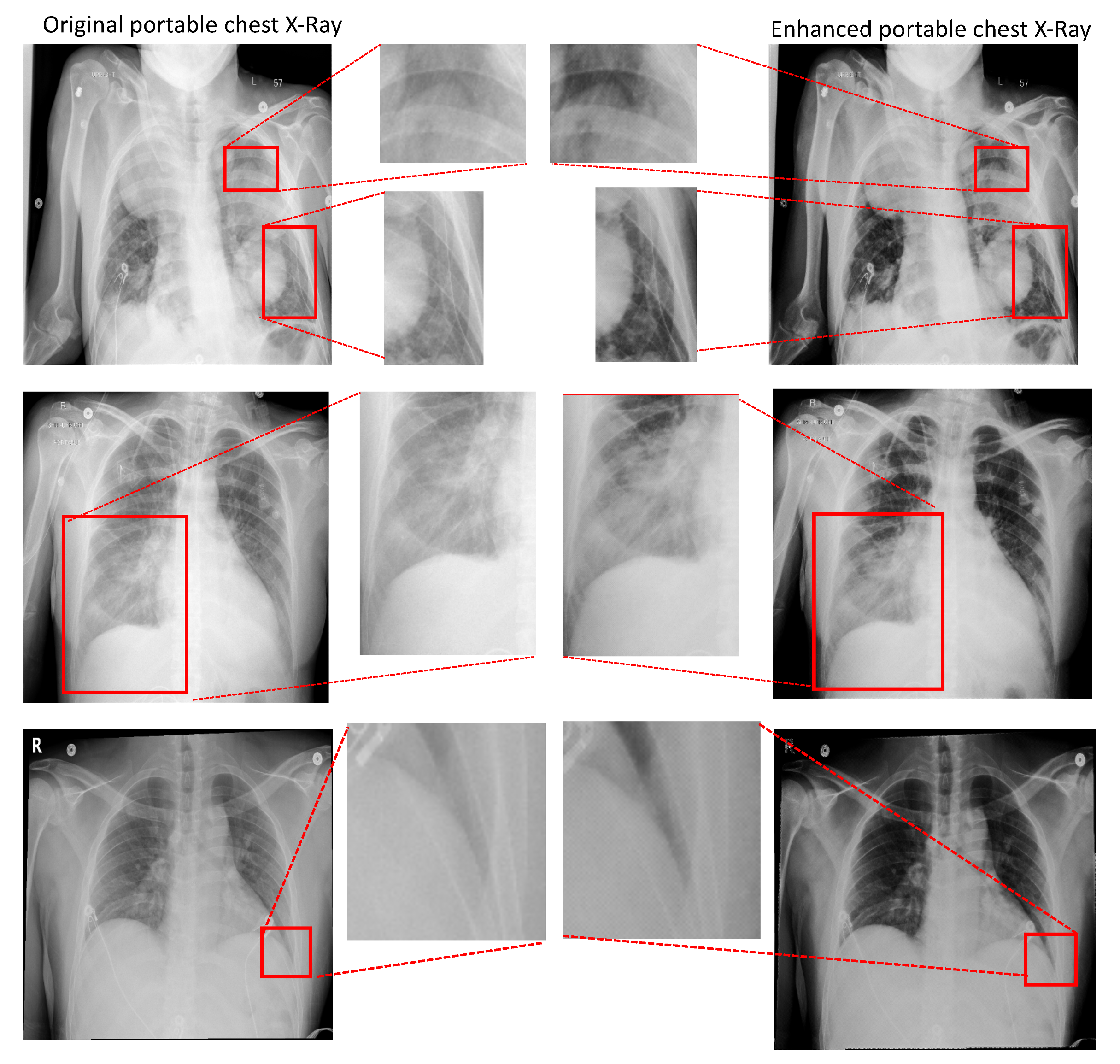 Diagnostics 11 01080 g010 Diagnostics 11 01080 g010