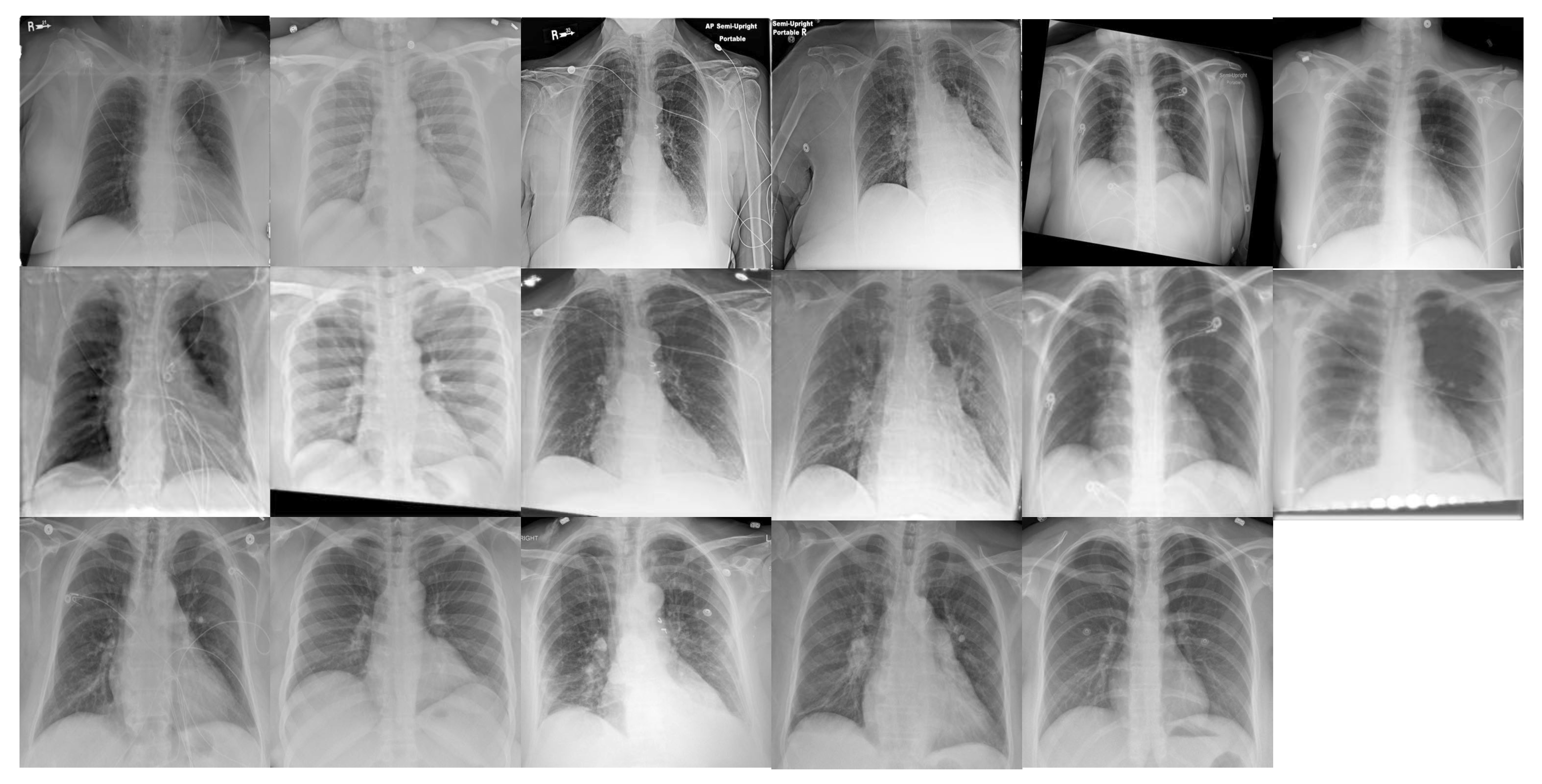 Diagnostics 11 01080 g011 Diagnostics 11 01080 g011