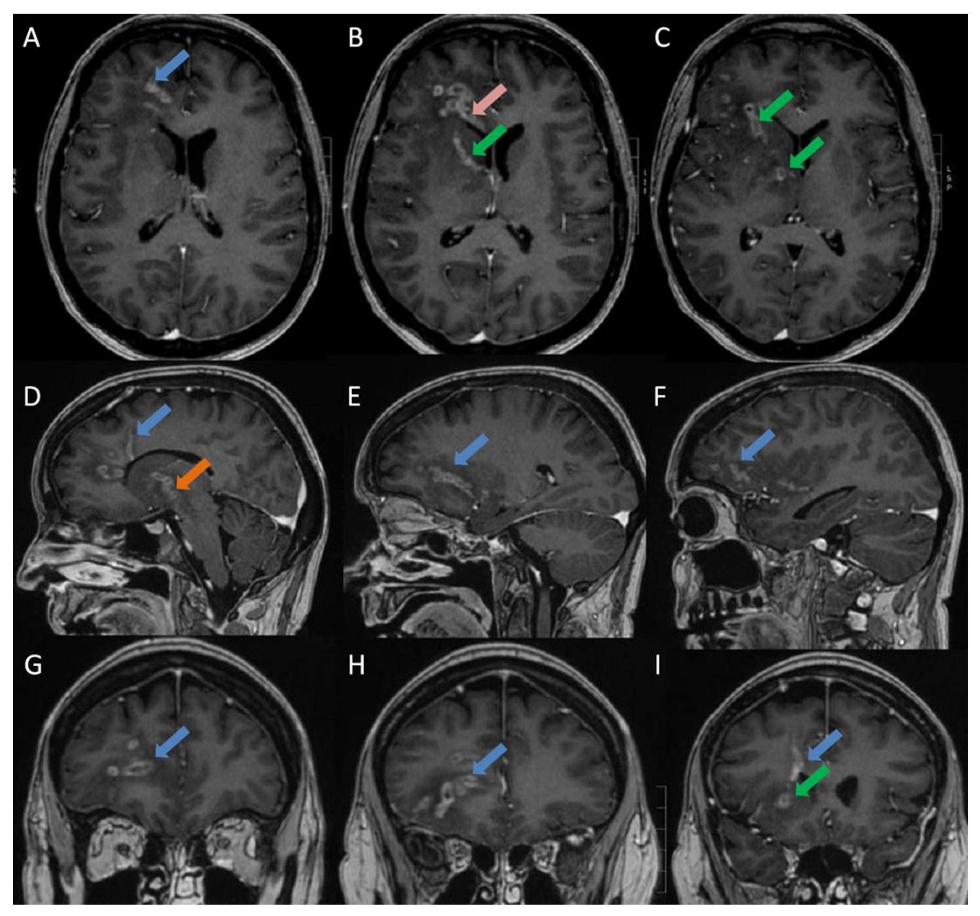 Diagnostics 11 01115 g001 Diagnostics 11 01115 g001