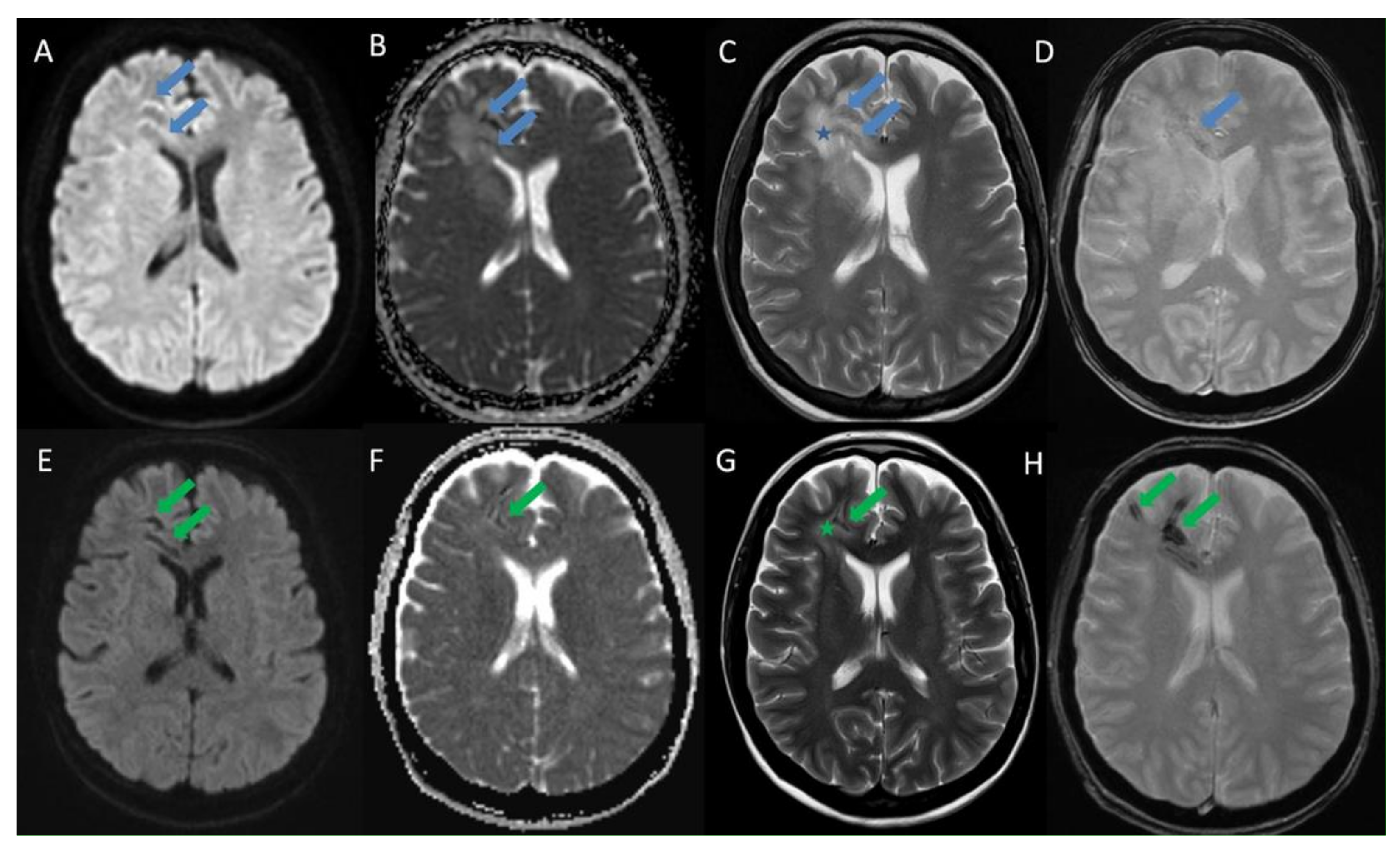 Diagnostics 11 01115 g002 Diagnostics 11 01115 g002