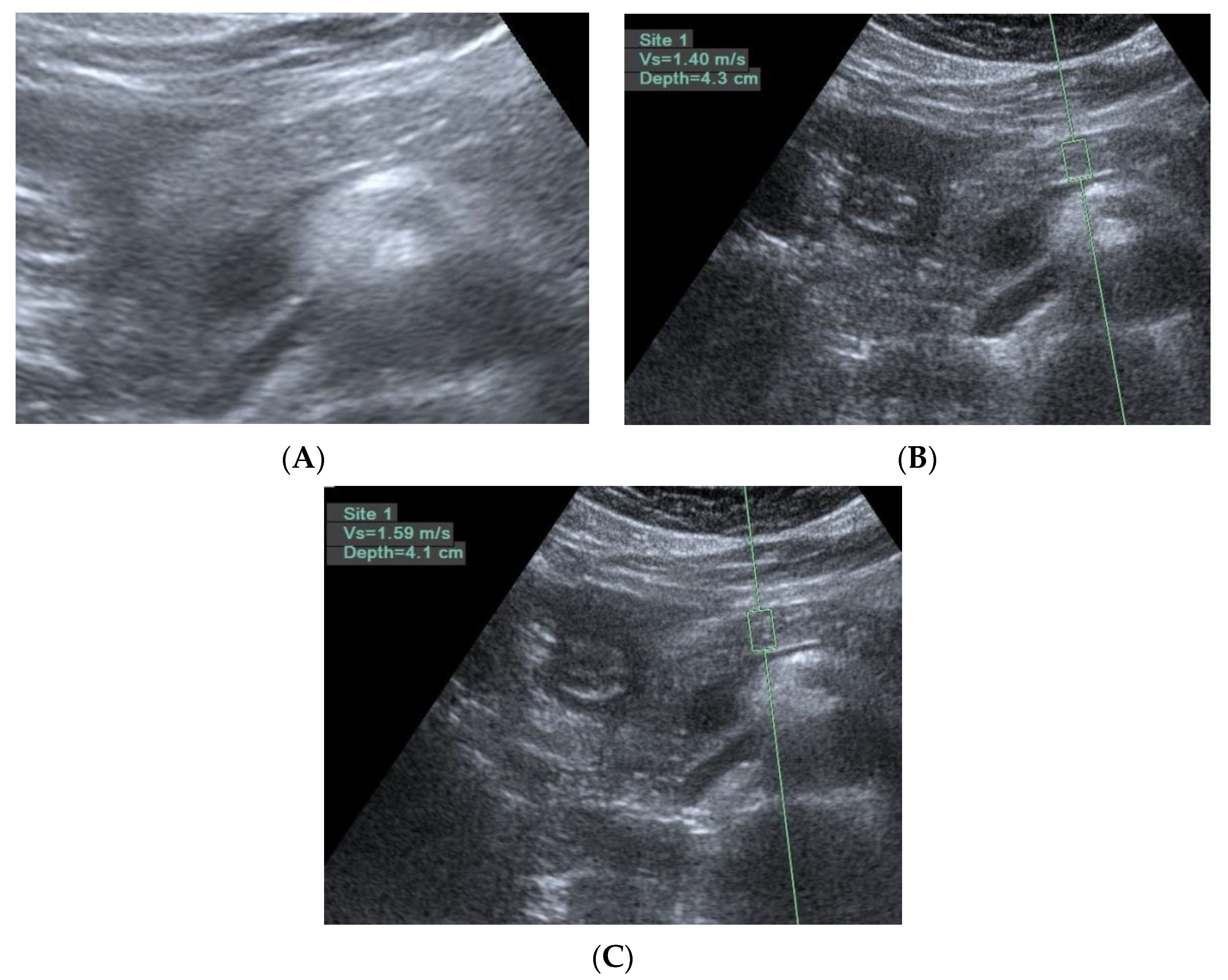 Diagnostics 11 01252 g005 Diagnostics 11 01252 g005