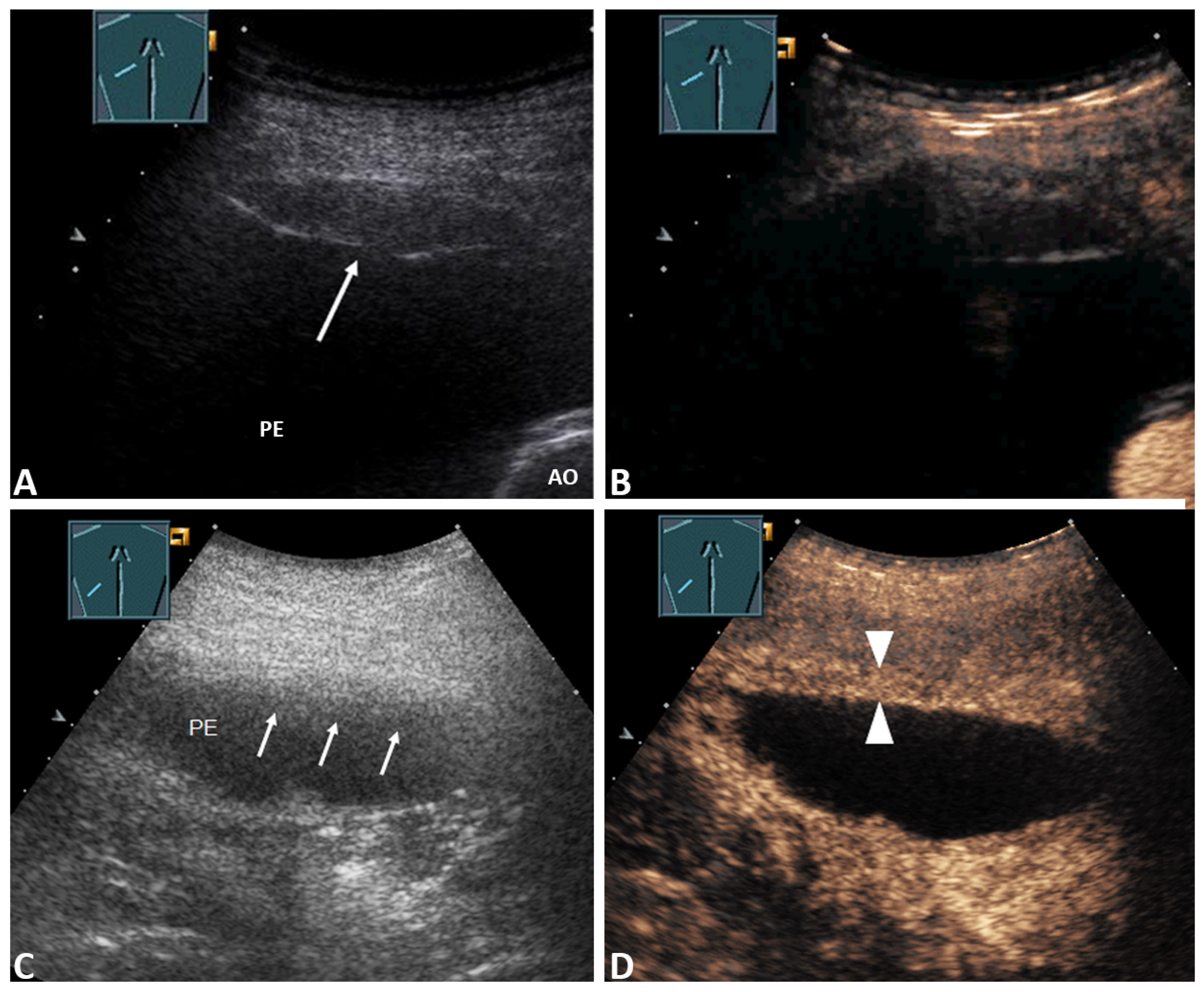 Contrast Media in Radiology – Undergraduate Diagnostic Imaging Fundamentals