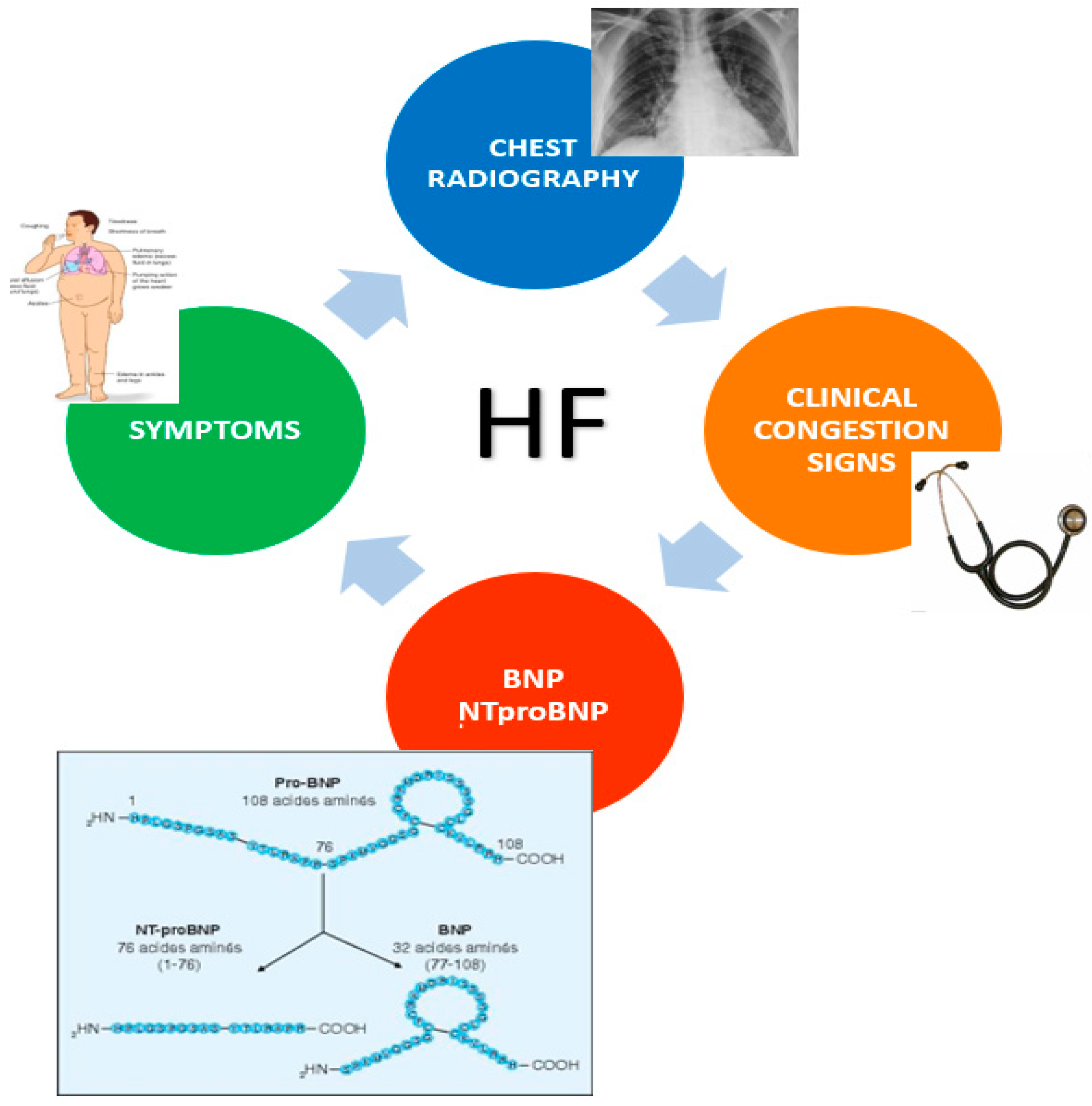 Diagnostics | Free Full-Text | Pulmonary Congestion Assessment in Heart  Failure: Traditional and New Tools | HTML