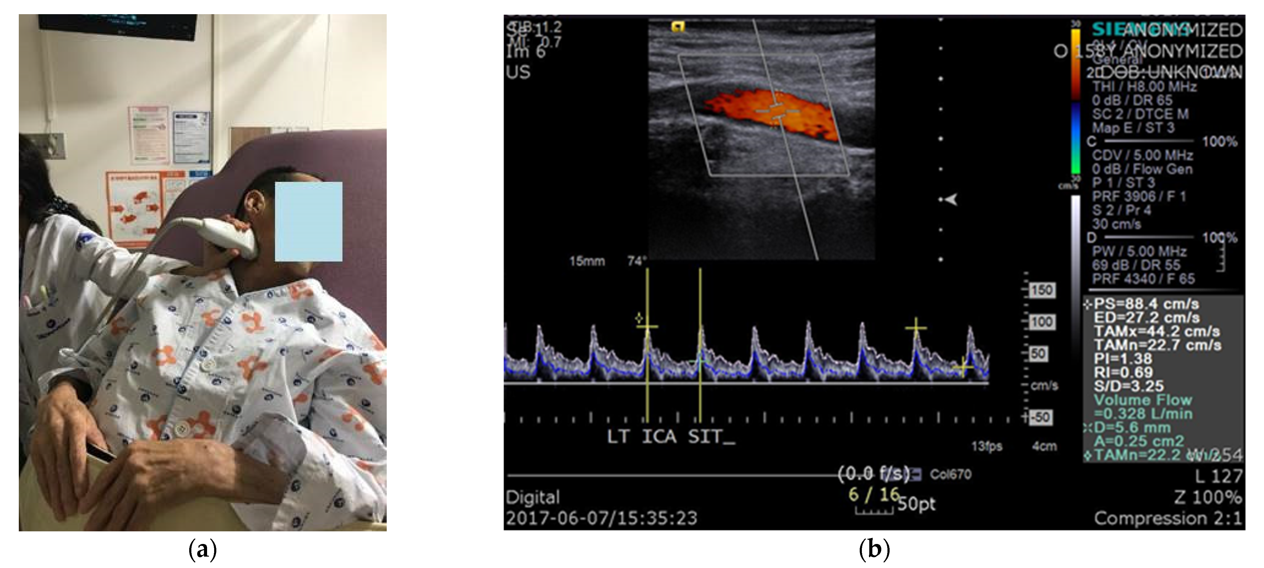 Diagnostics 11 01321 g001 Diagnostics 11 01321 g001