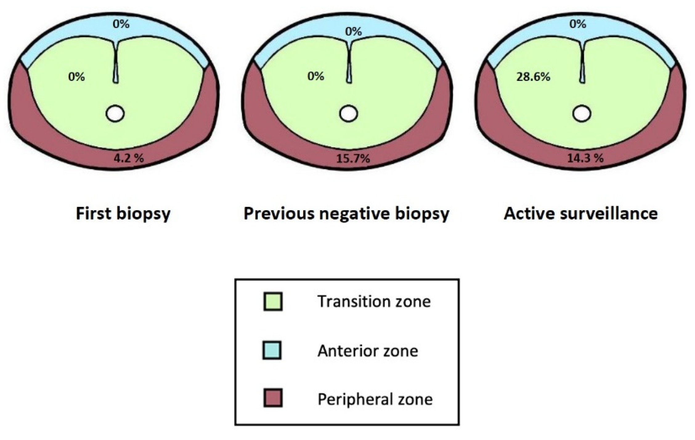 Diagnostics | Free Full-Text | Does Adding Standard Systematic Biopsy to  Targeted Prostate Biopsy in PI-RADS 3 to 5 Lesions Enhance the Detection of  Clinically Significant Prostate Cancer? Should All Patients with