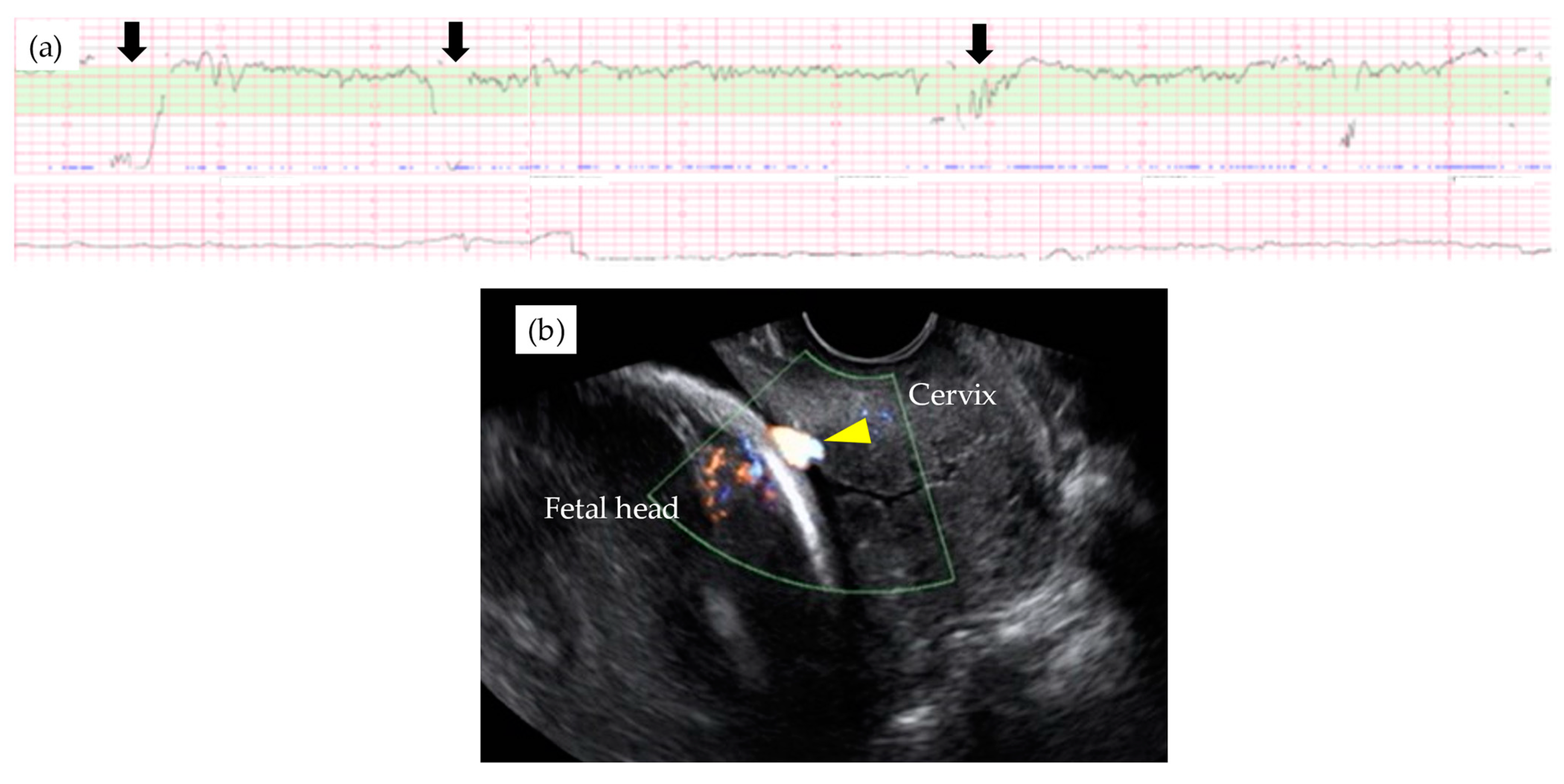Diagnostics 11 01369 g002