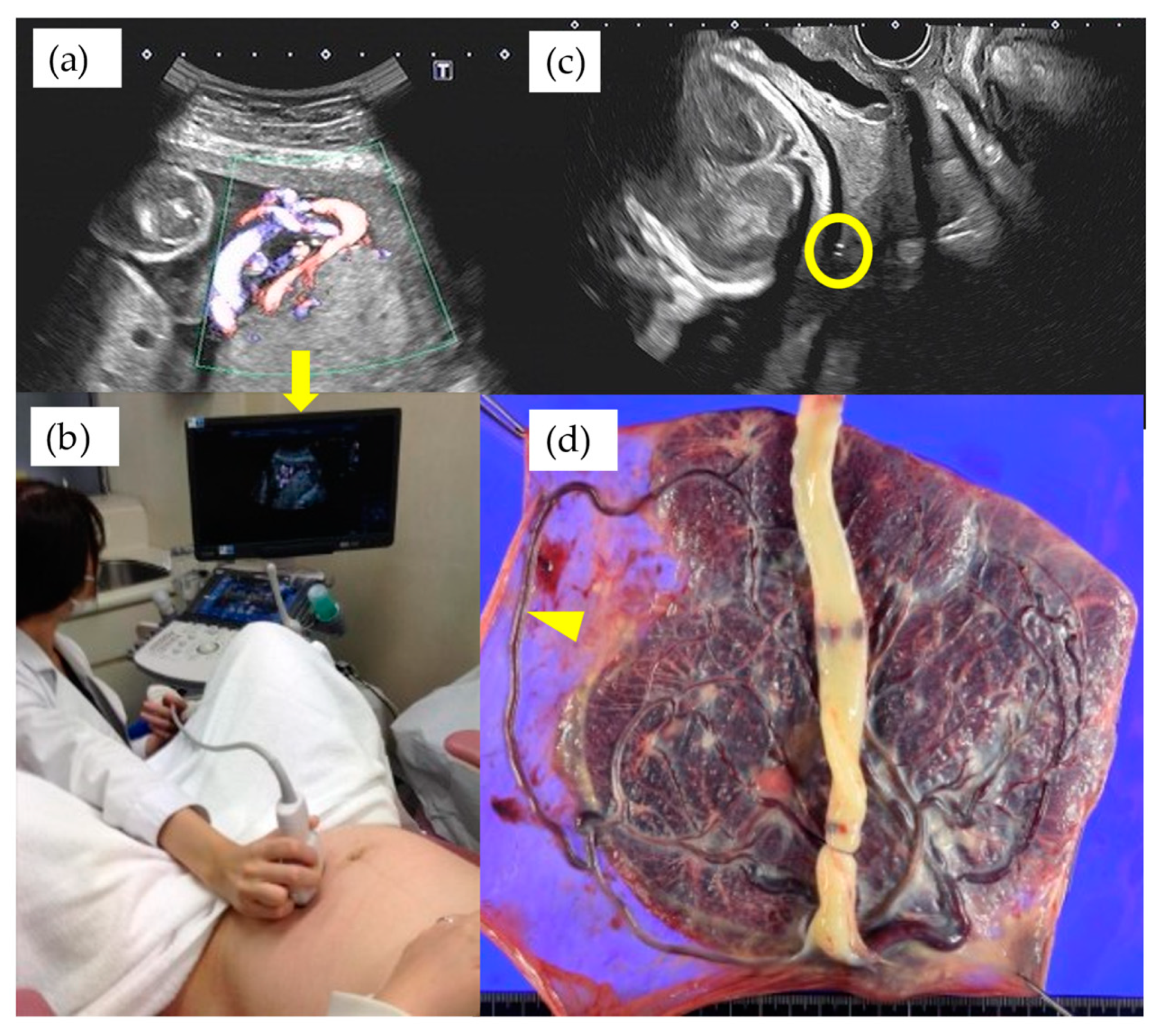Diagnostics 11 01369 g004