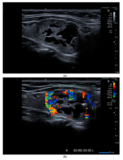 Diagnostics | Free Full-Text | Thyroid Nodule Characterization: How to ...