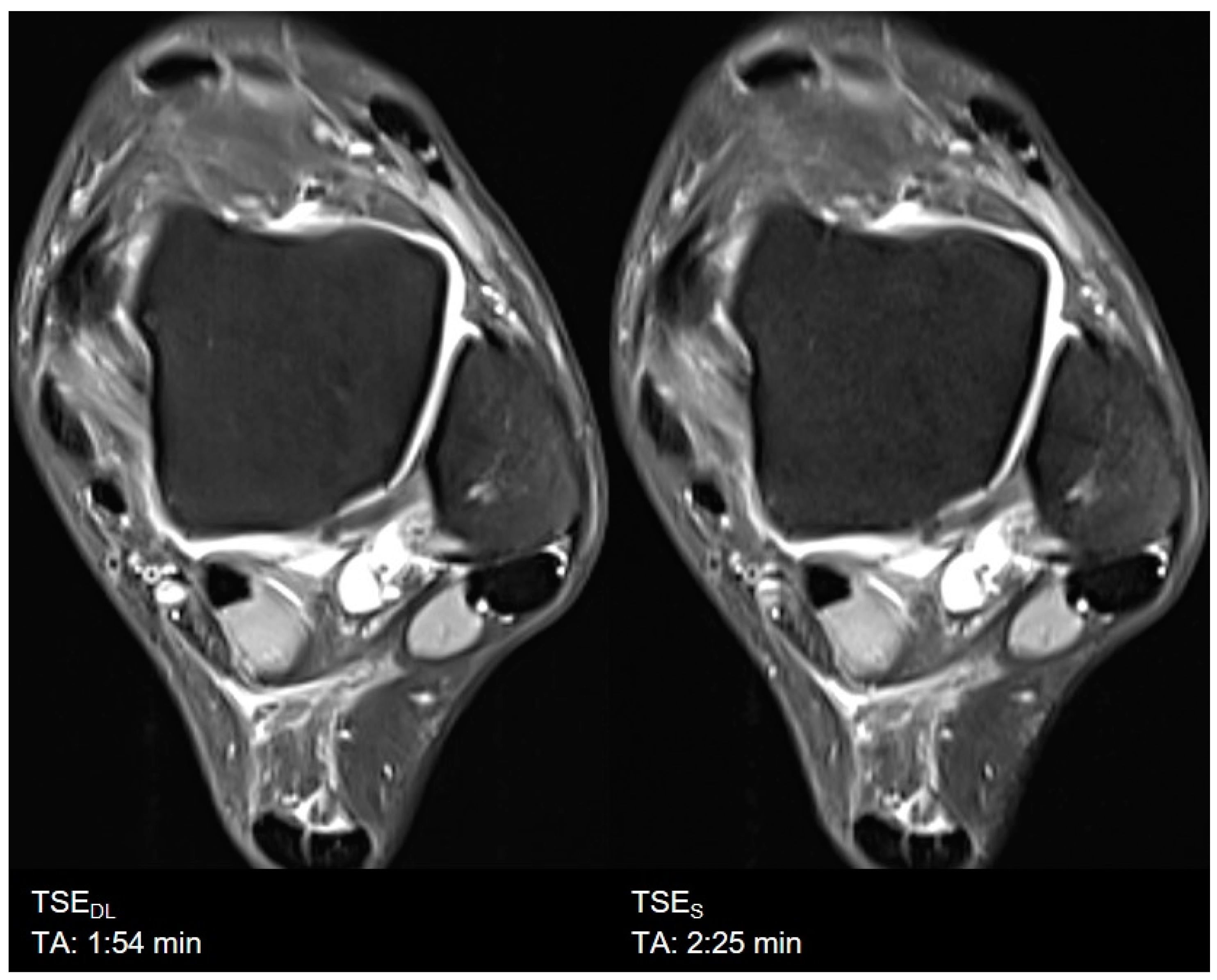 Diagnostics 11 01484 g007