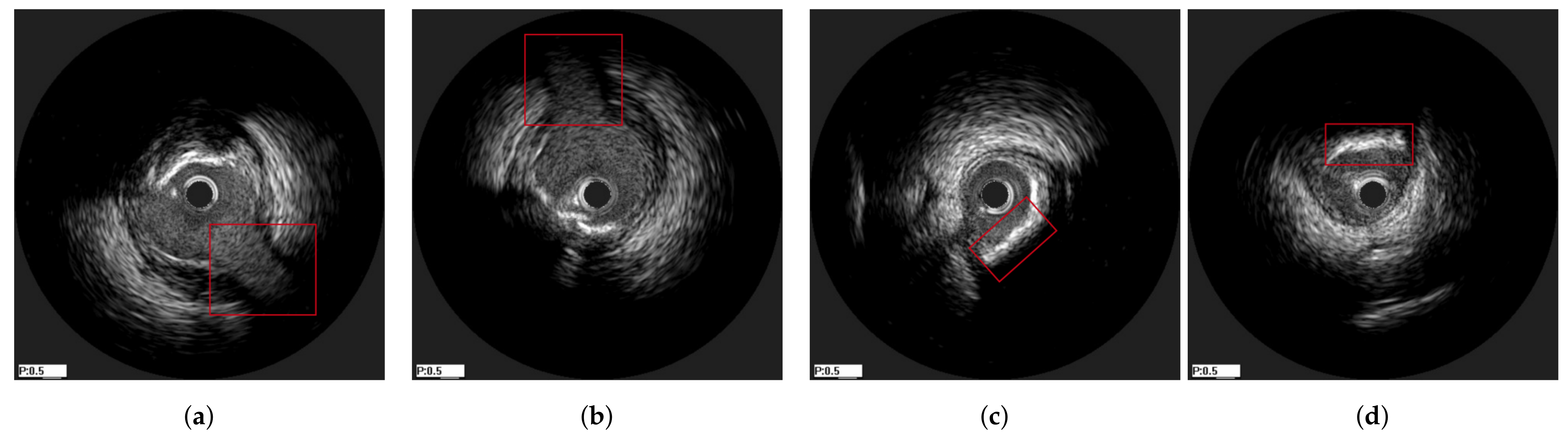 Diagnostics 11 01513 g004