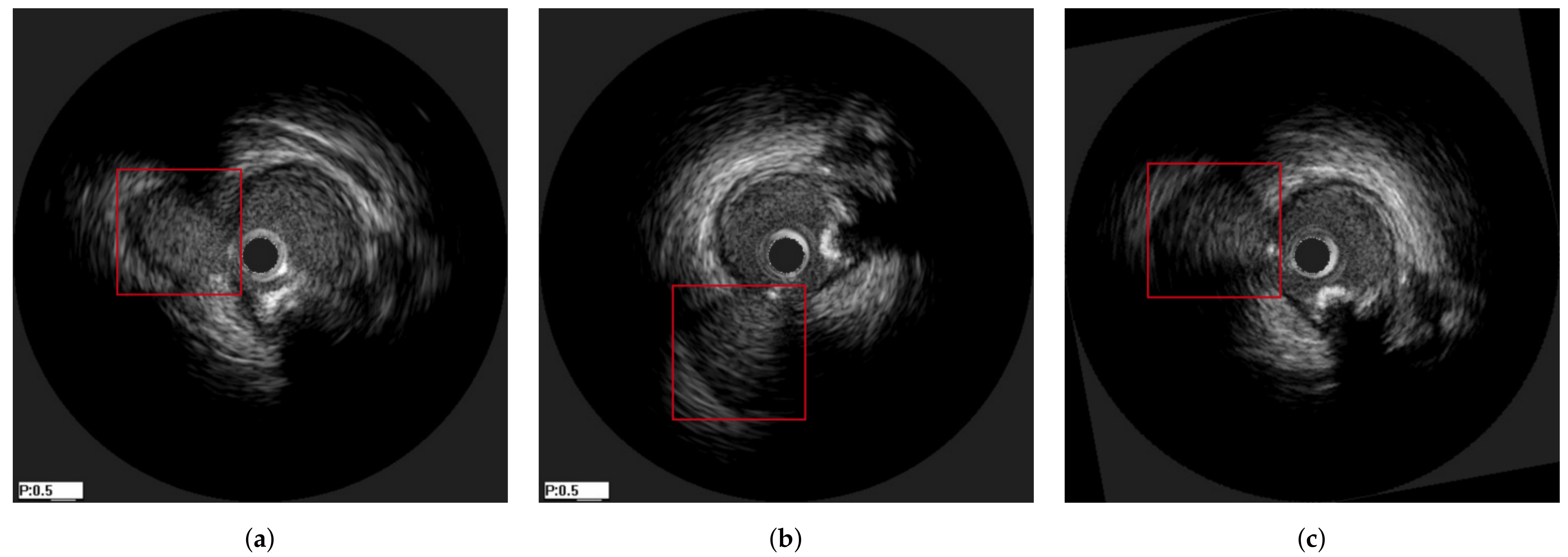 Diagnostics 11 01513 g010