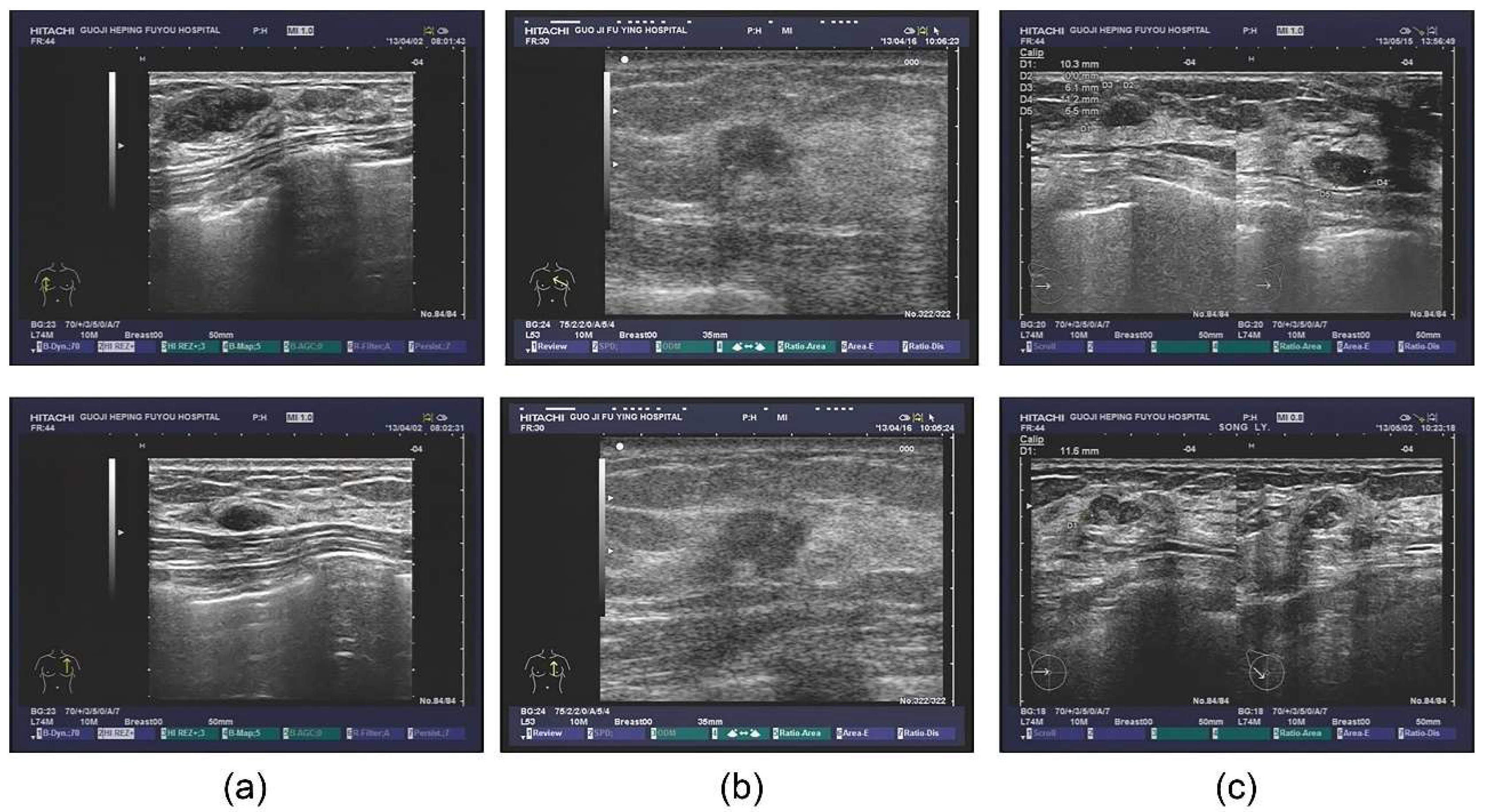 Diagnostics | Free Full-Text | Tumor Segmentation in Breast Ultrasound  Image by Means of Res Path Combined with Dense Connection Neural Network