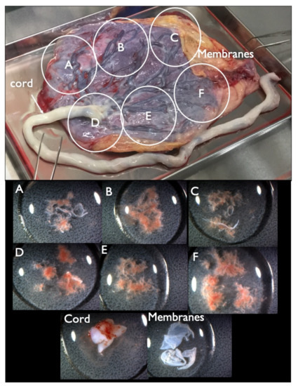 Diagnostics | Free Full-Text | Clinical Validation of Fetal cfDNA ...