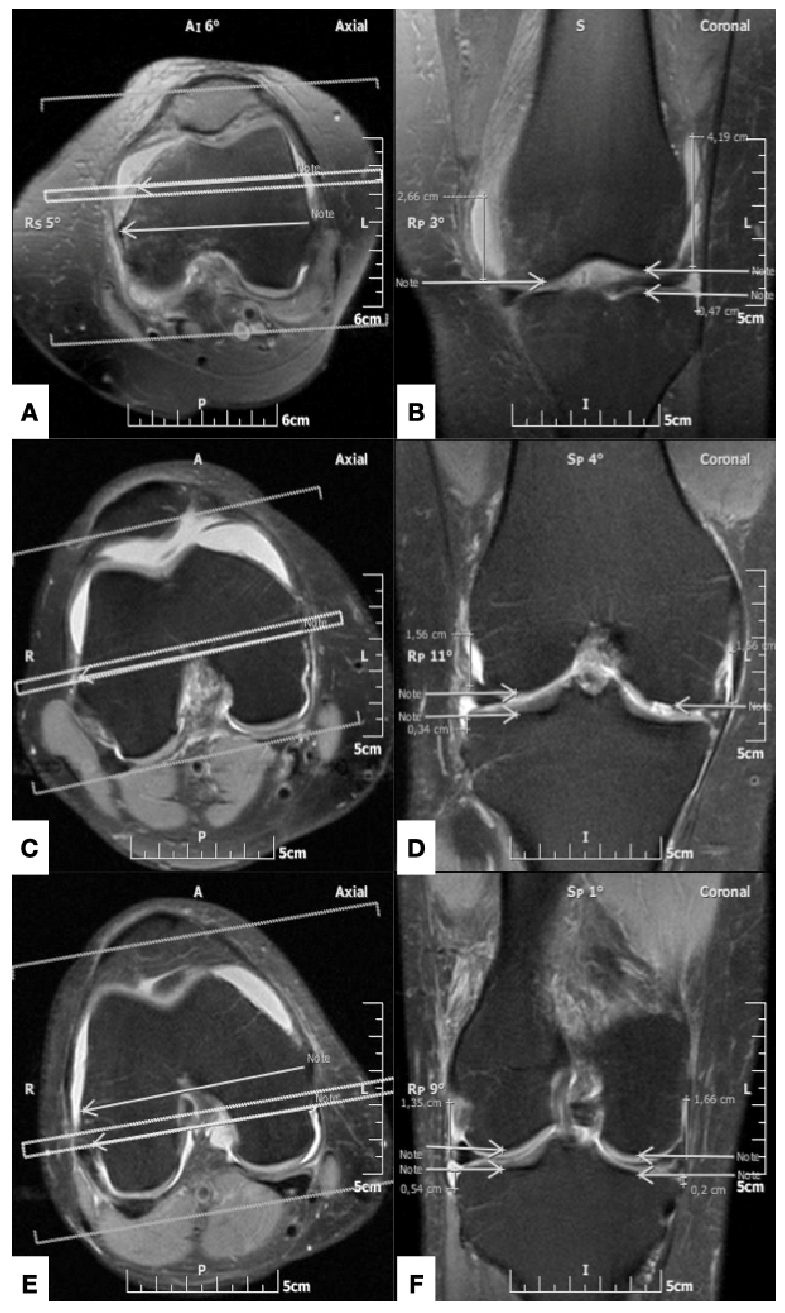 Diagnostics | Free Full-Text | Knee Capsule Anatomy: An MR Imaging