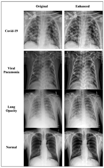 Diagnostics | Free Full-Text | COVID-19 Pneumonia Detection Using ...