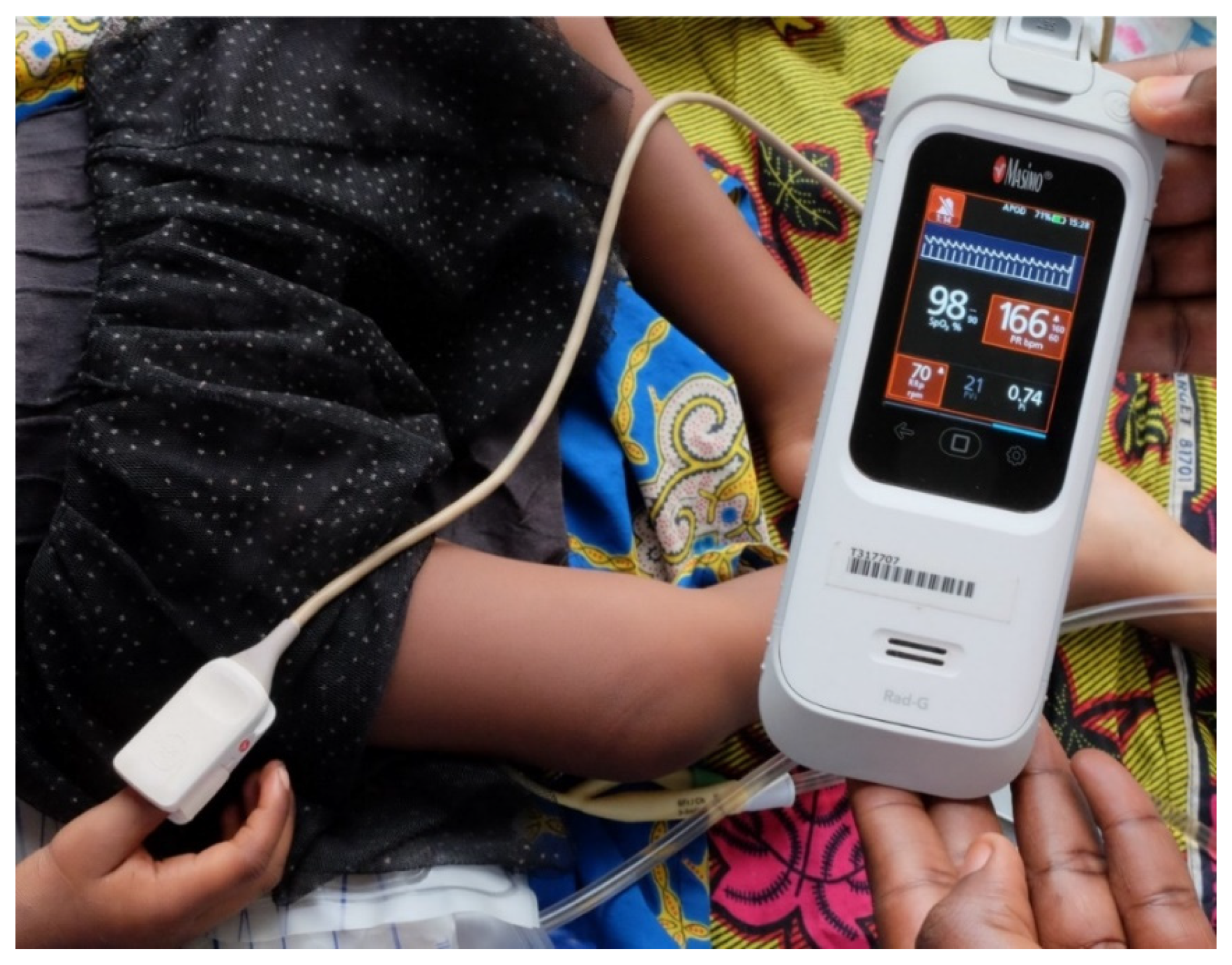 Diagnostics | Free Full-Text | Performance of Automated Point-of-Care  Respiratory Rate Counting versus Manual Counting in Children under Five  Admitted with Severe Febrile Illness to Kisantu Hospital, DR Congo