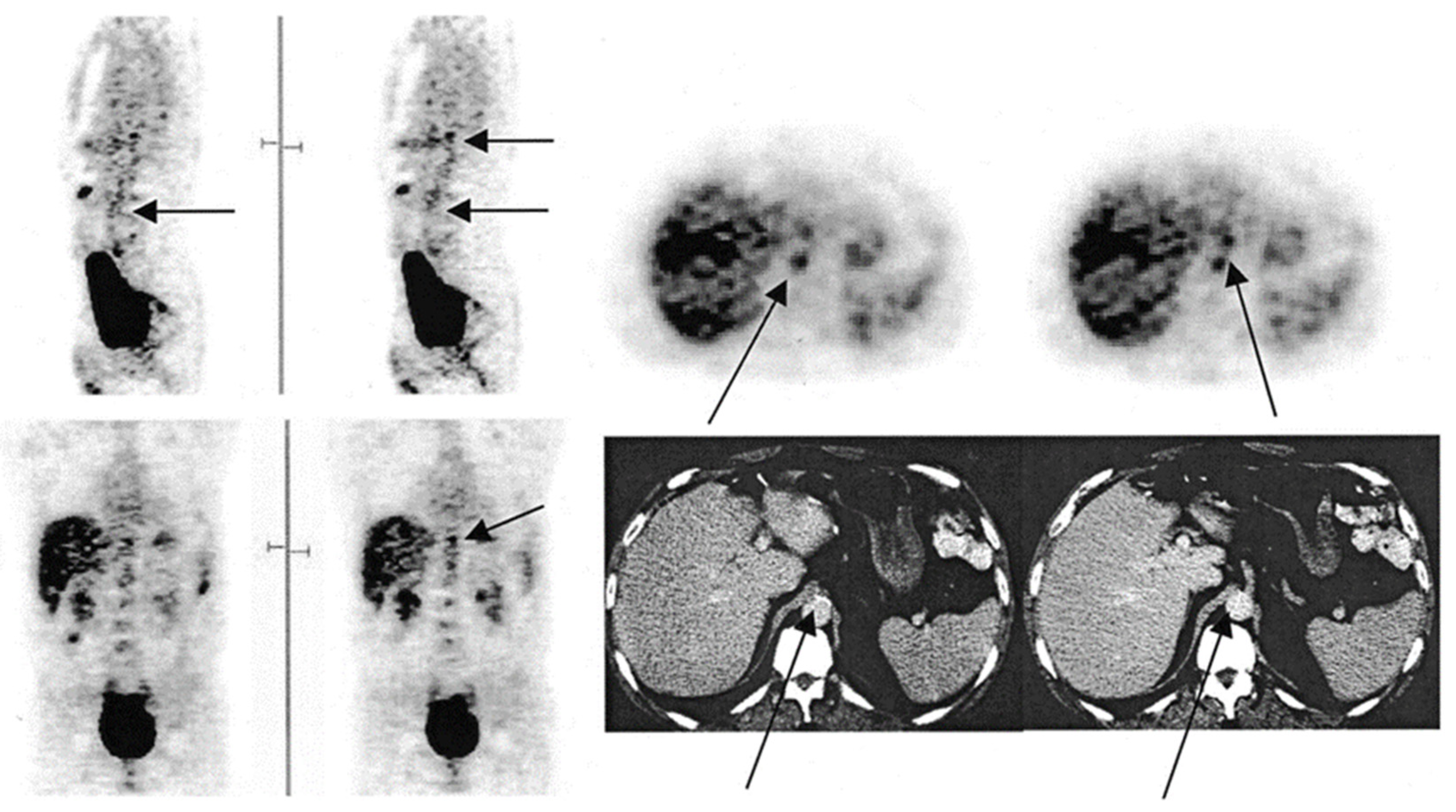 Diagnostics Free Full Text PET Based Imaging with 18F FDG and