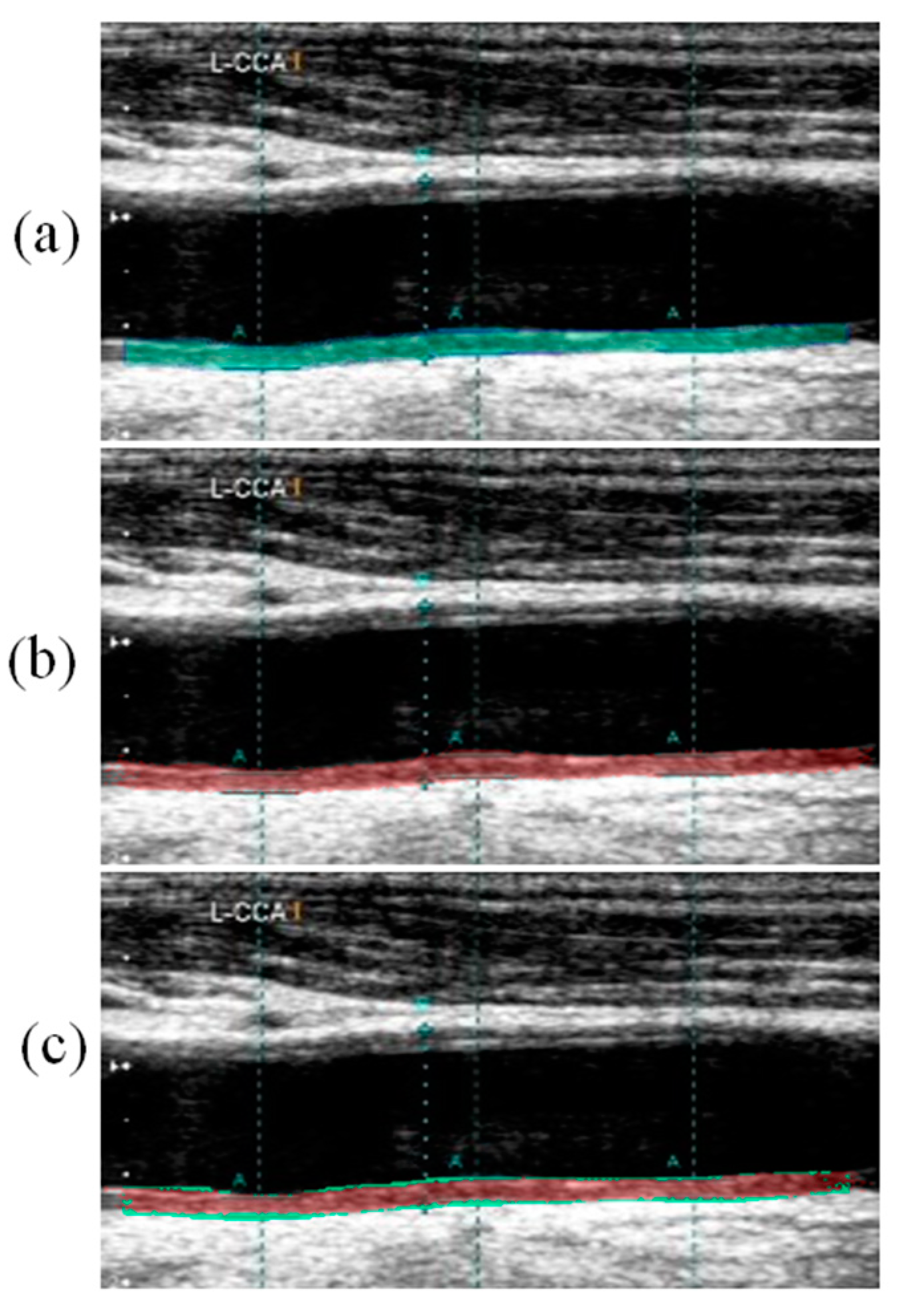 Diagnostics 11 02257 g004 Diagnostics 11 02257 g004