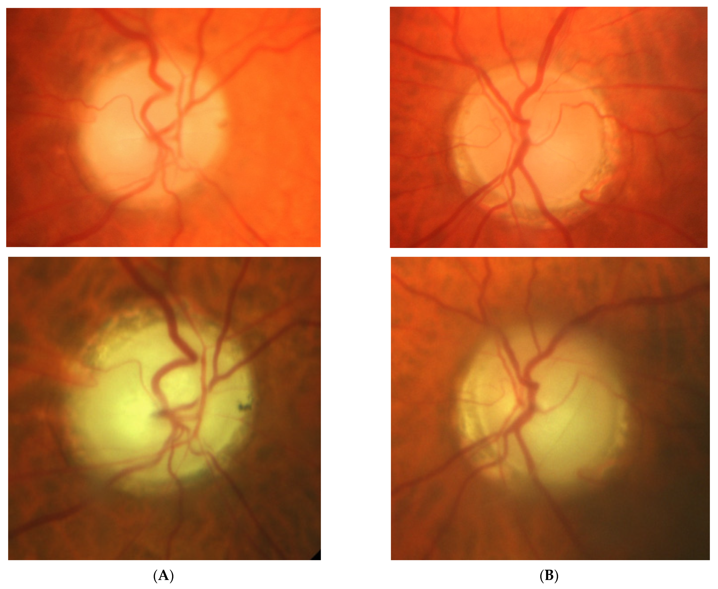Diagnostics 11 02374 g002a
